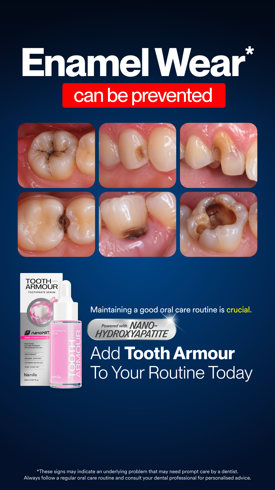 Hismile Facebook ad