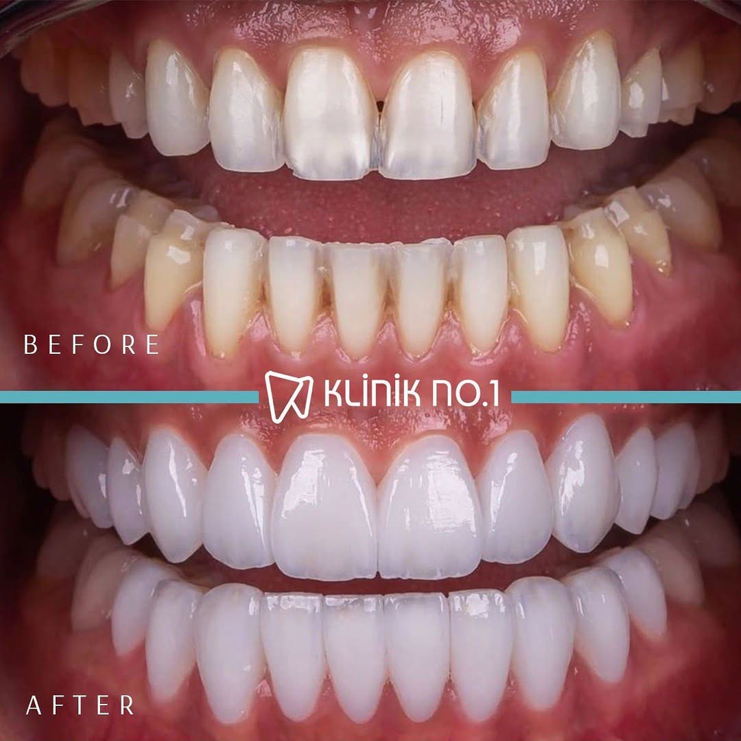 Klinik No 1 Global Facebook ad: COSMETIC DENTISTRY in TURKEY