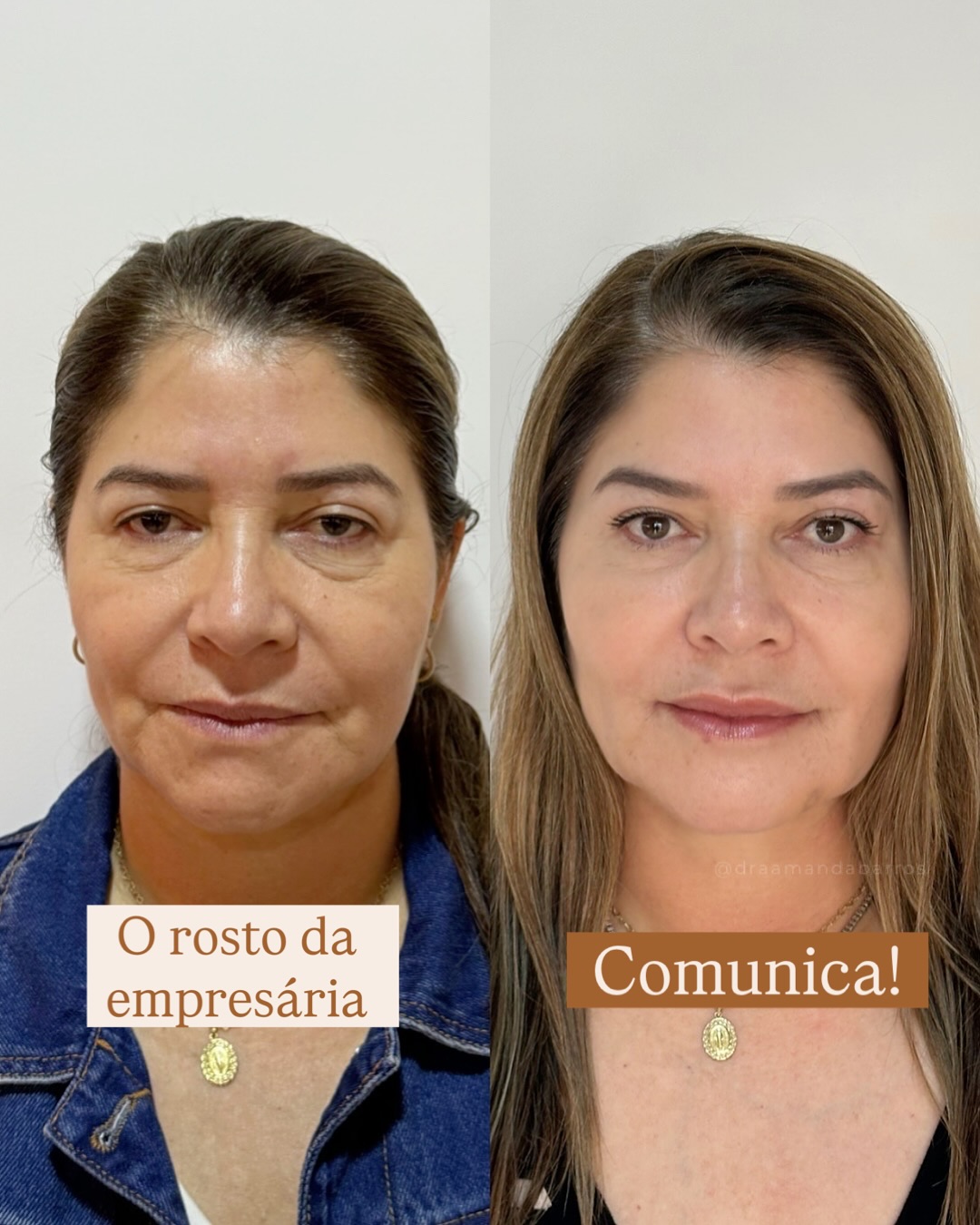 Dra. Amanda Barros Facebook ad: A sua imagem IMPORTA!