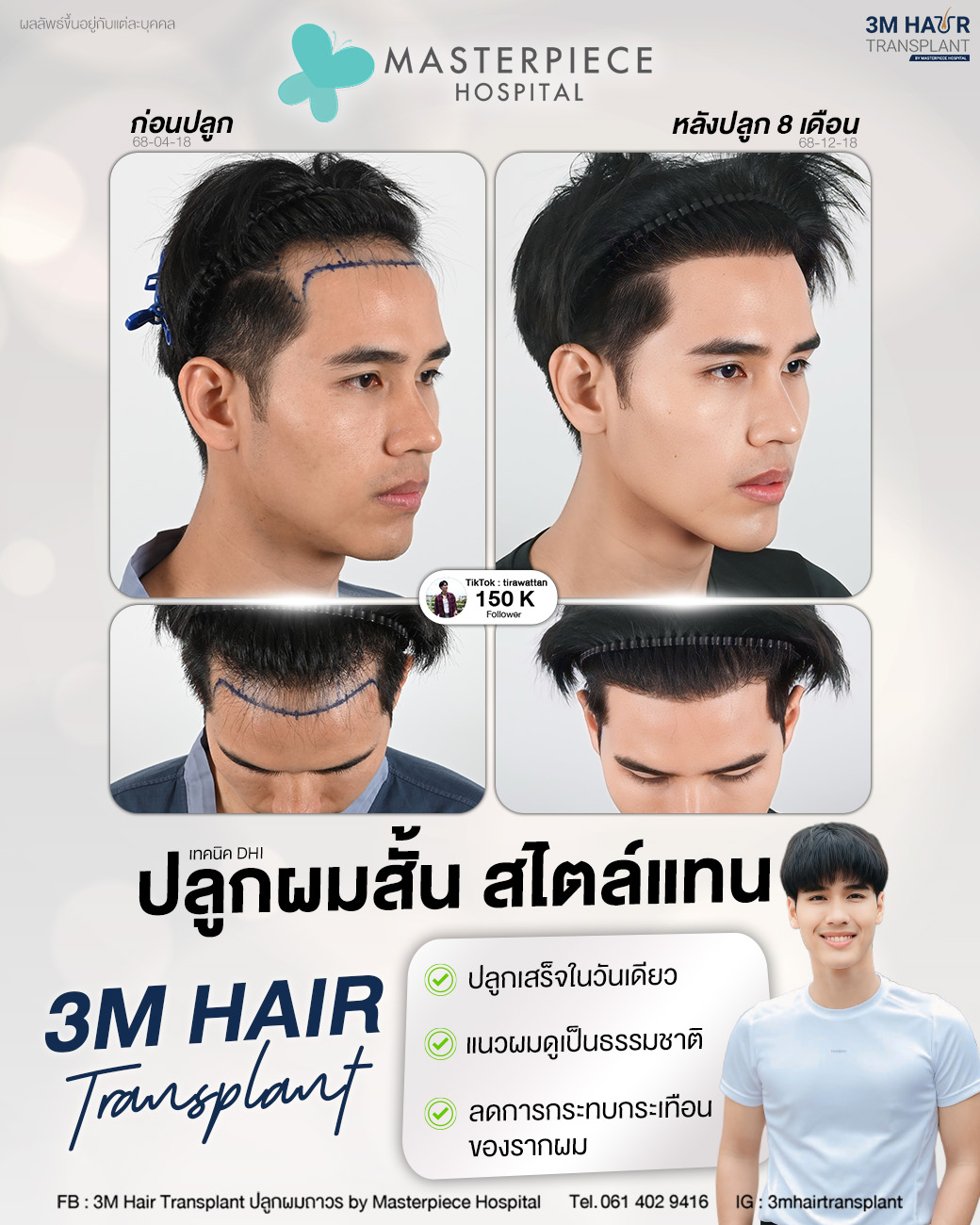Masterpiece Hospital Facebook ad: โปรพิเศษเฉพาะช่วงนี้