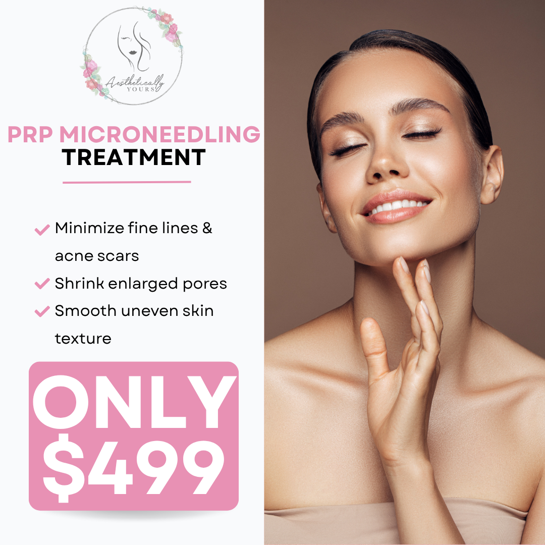 Aesthetically Yours Facebook ad: $499 PRP Microneedling Treatment!