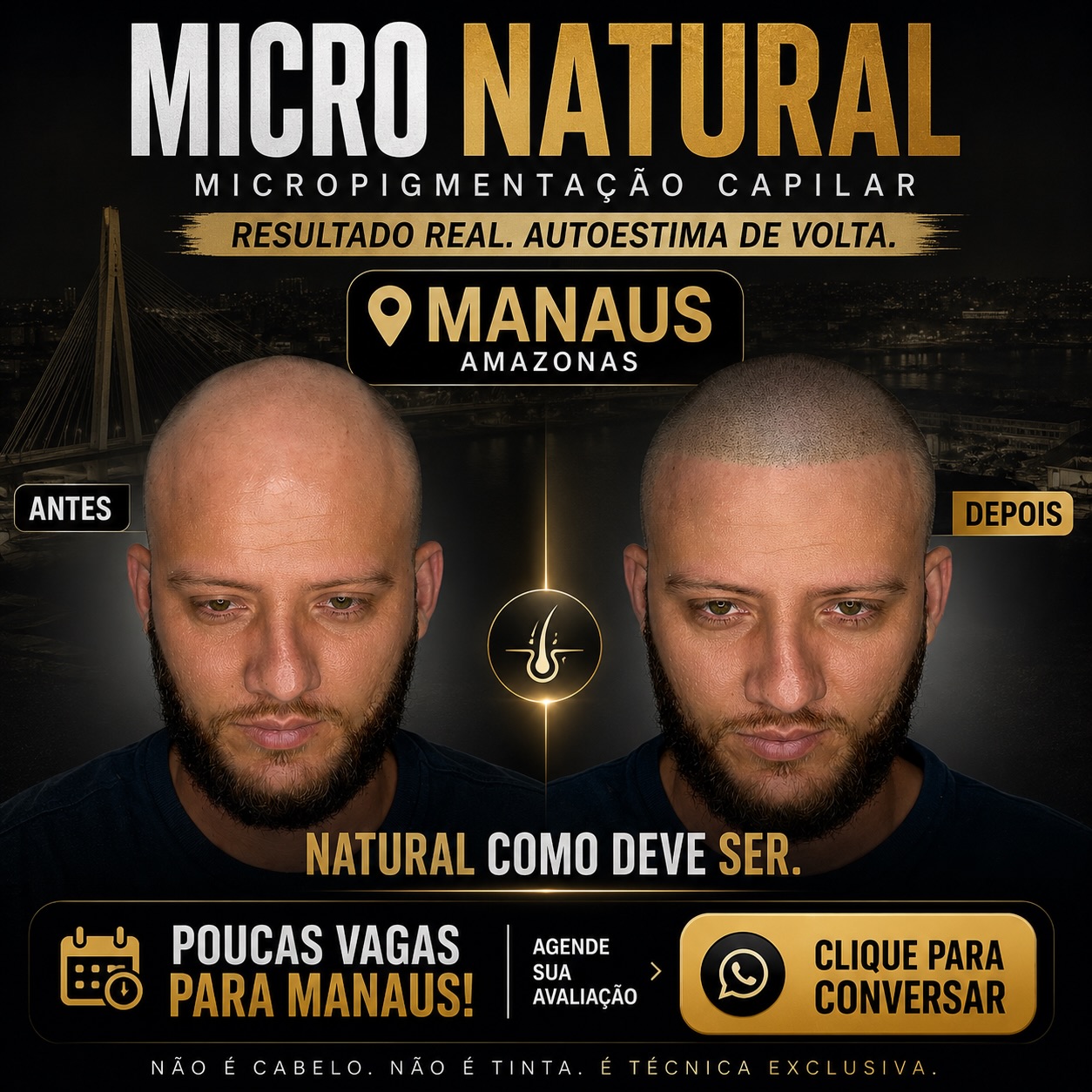 Capiclin Facebook ad: MANAUS - AMAZONAS