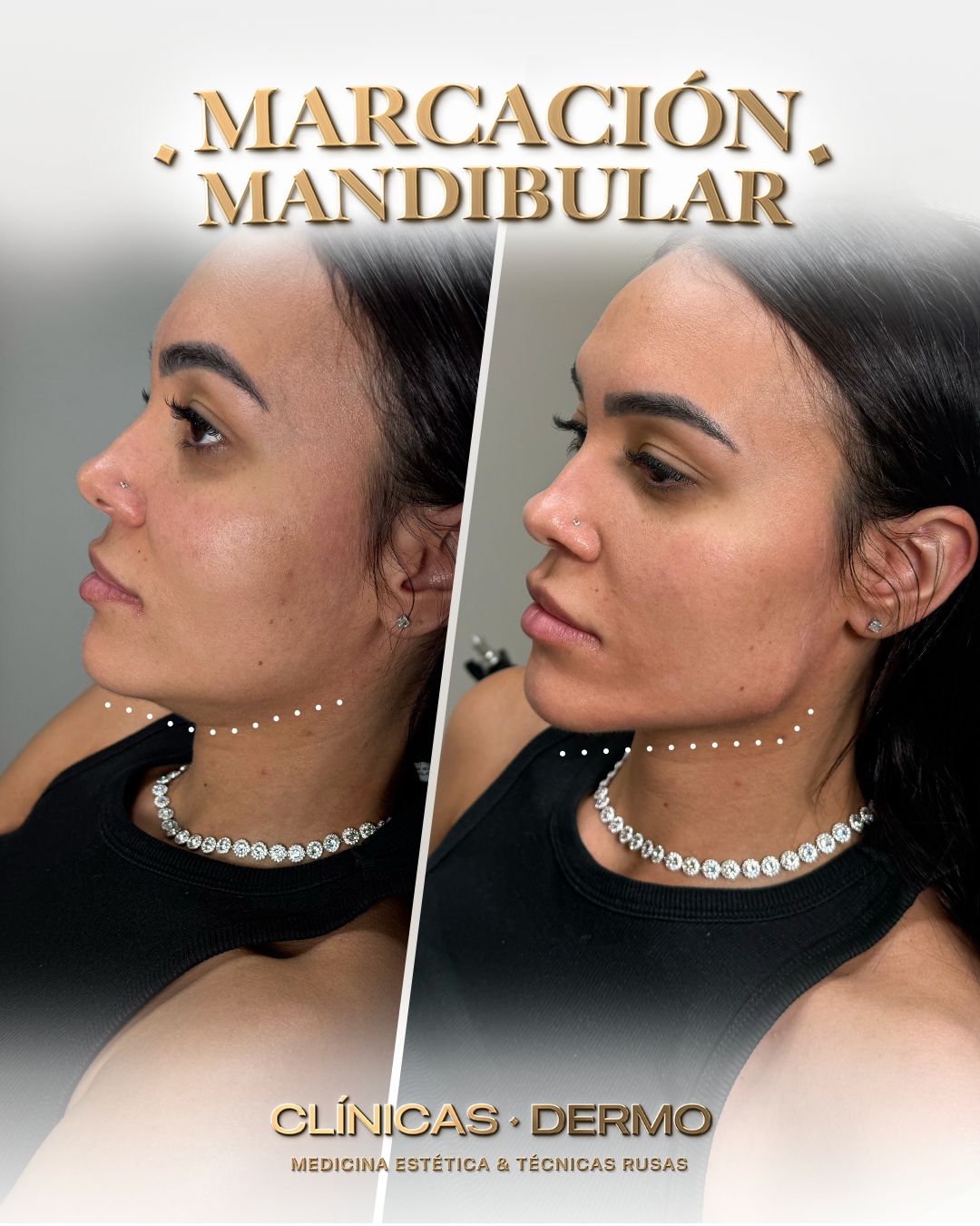 Dermo Clinic Chorbadzhyiiska Facebook ad
