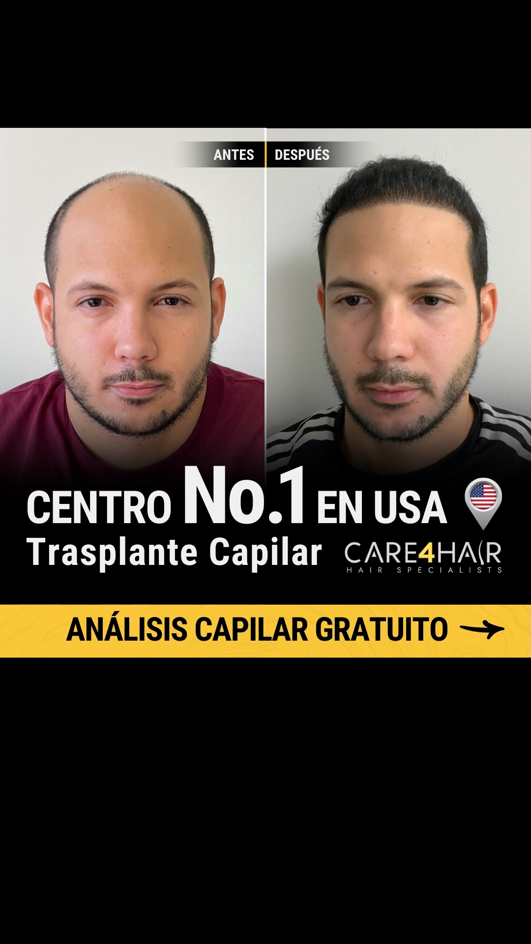 Care4Hair Facebook ad