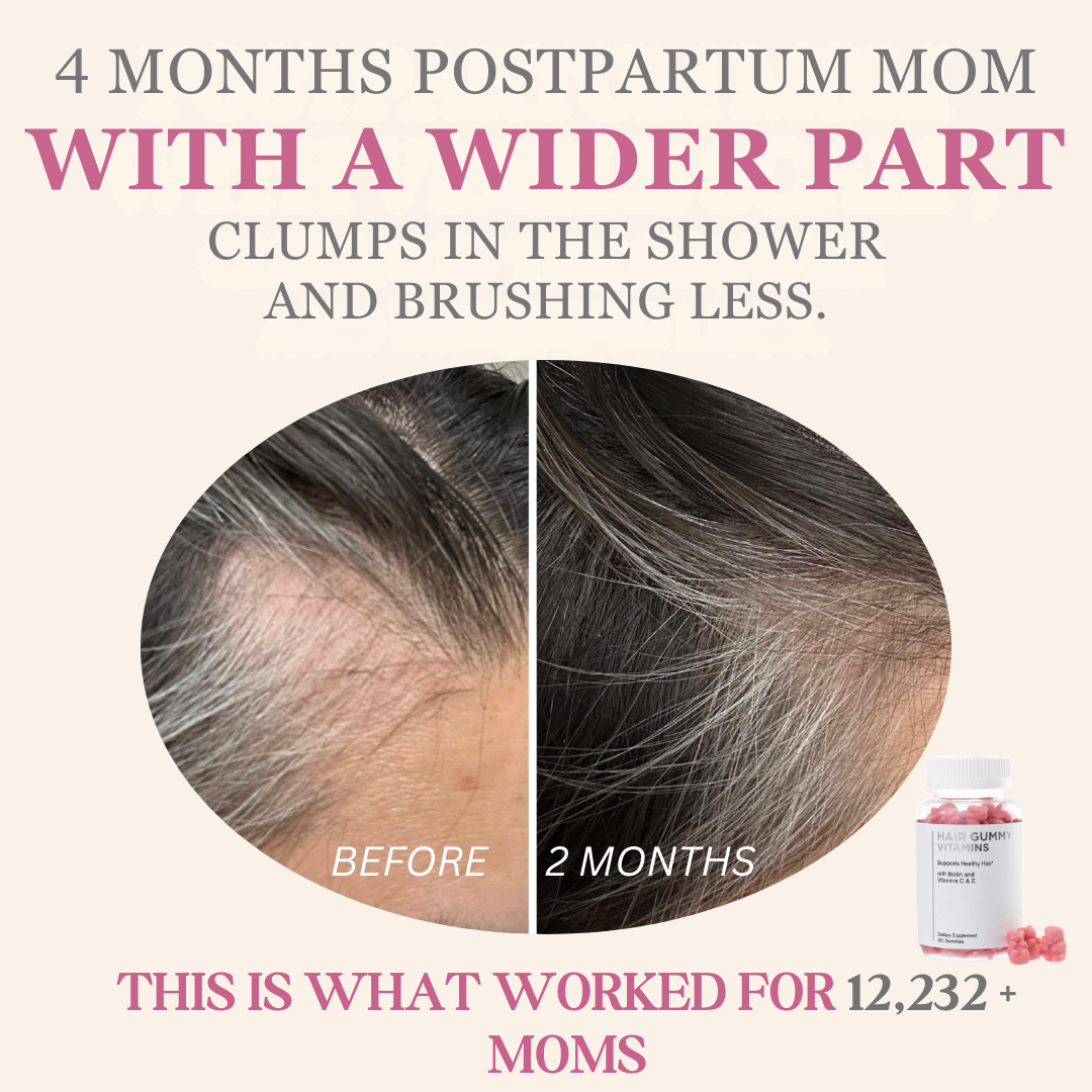 TRY UMMI Facebook ad: Wider Part After Baby? This Is What Actually Helps