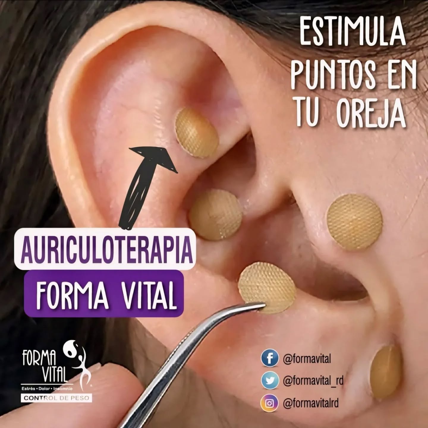 Forma Vital Dominicana Facebook ad: AURICULOTERAPIA BENEFICIOS