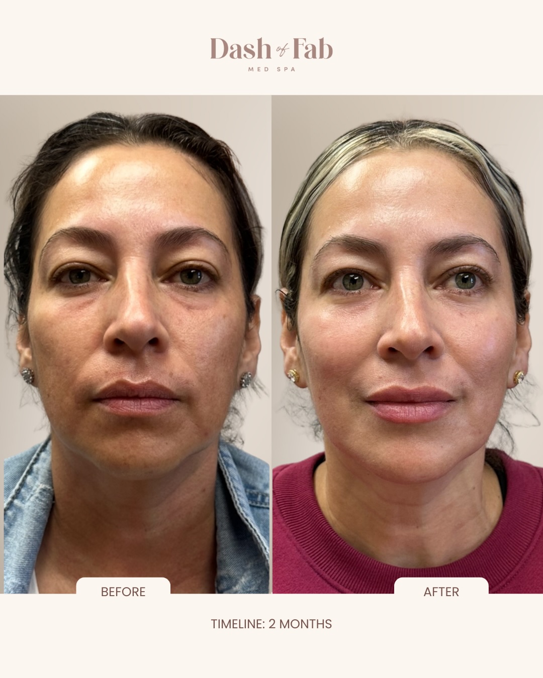 Dash of Fab Med Spa Facebook ad