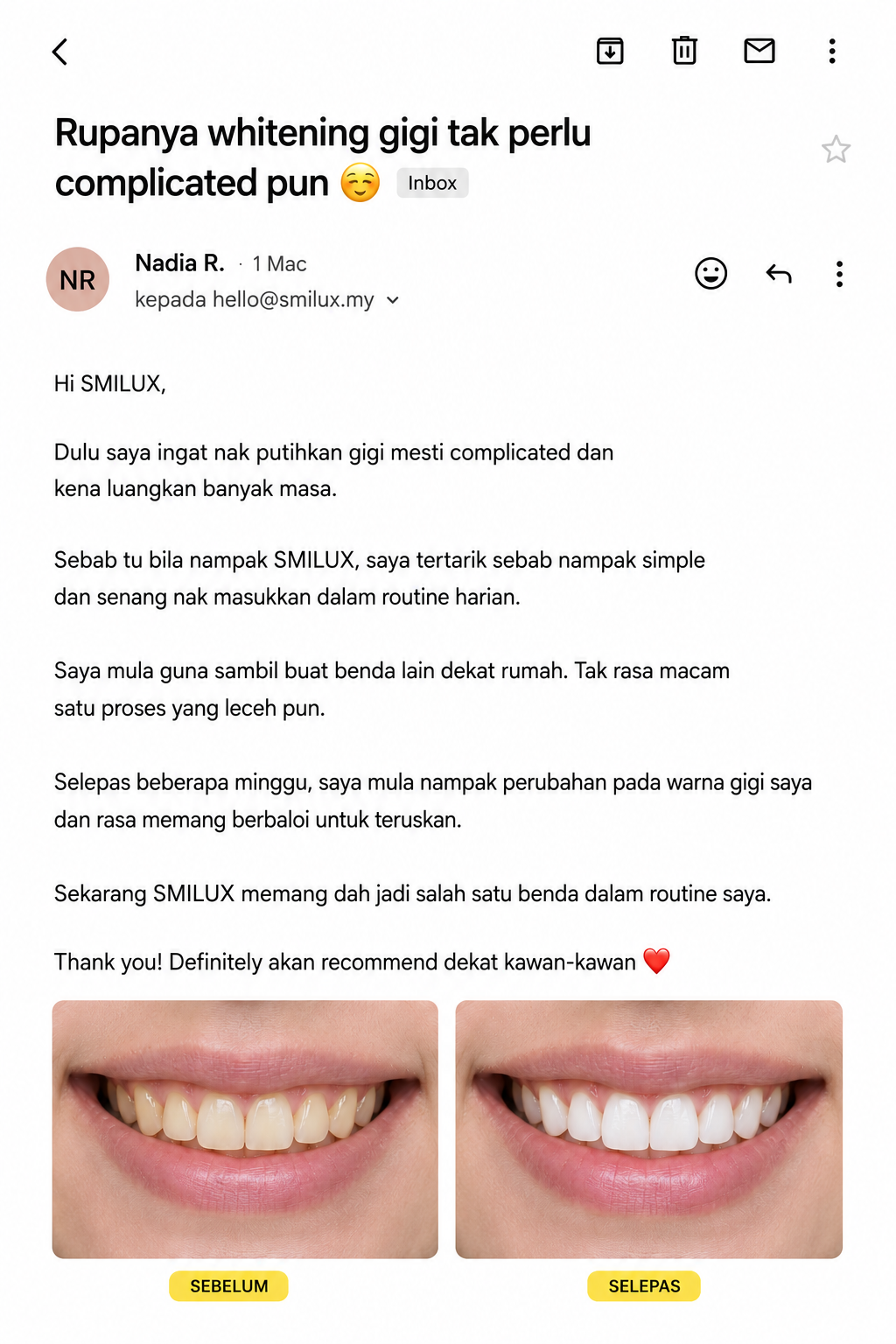 Smilux Malaysia Facebook ad: FREE SHIPPING Semenanjung FREE EXTRA STRIP untuk bulan ni