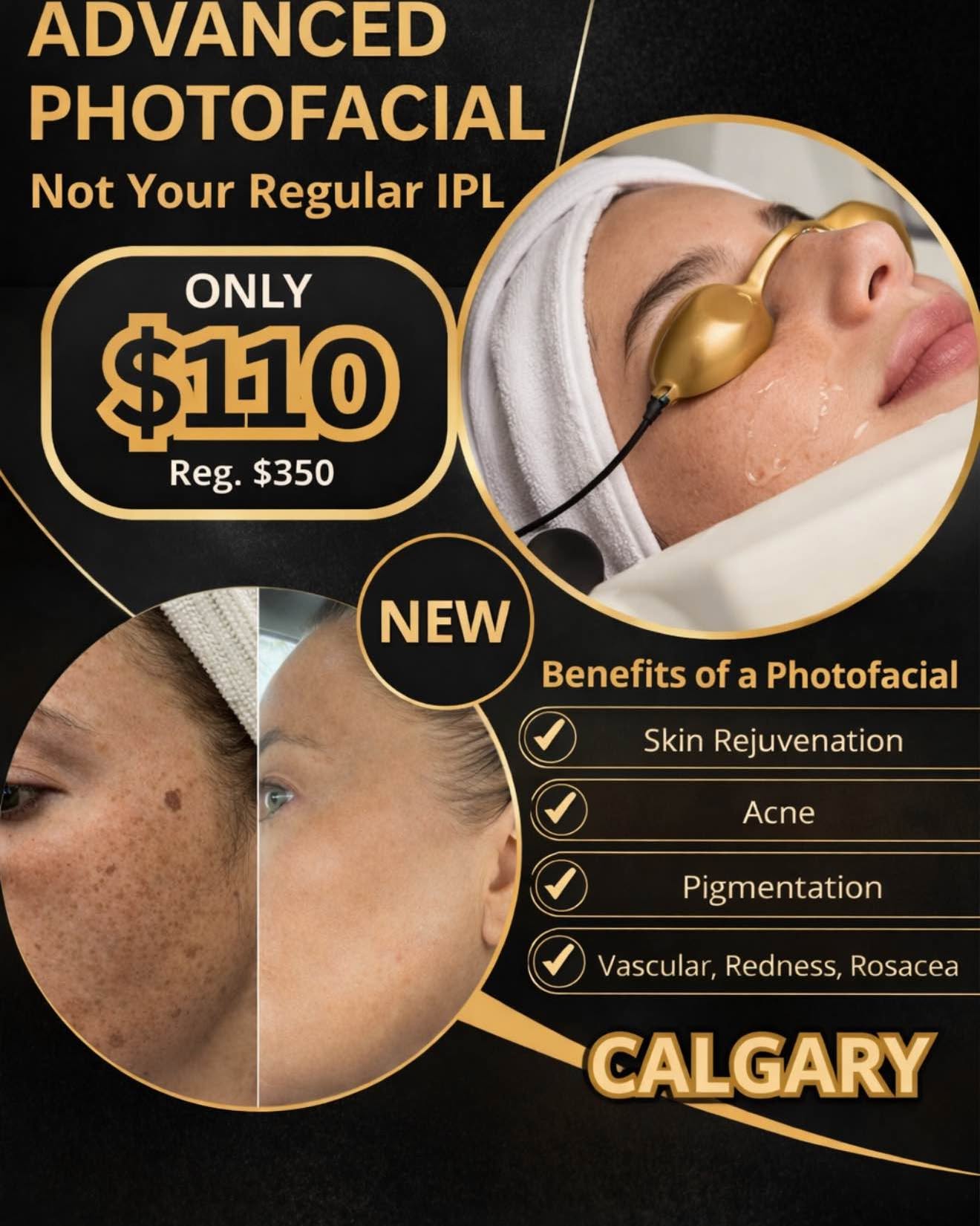 Ria Sean Facebook ad: Photo facial ( IPL)