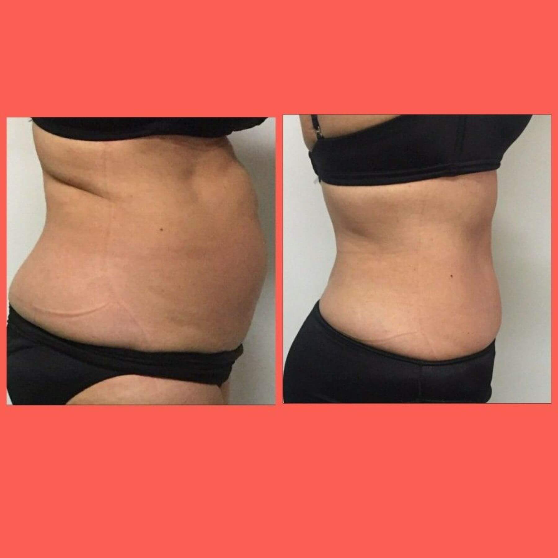Alice Miller Facebook ad: Belly Pouch Ruining Your Life?