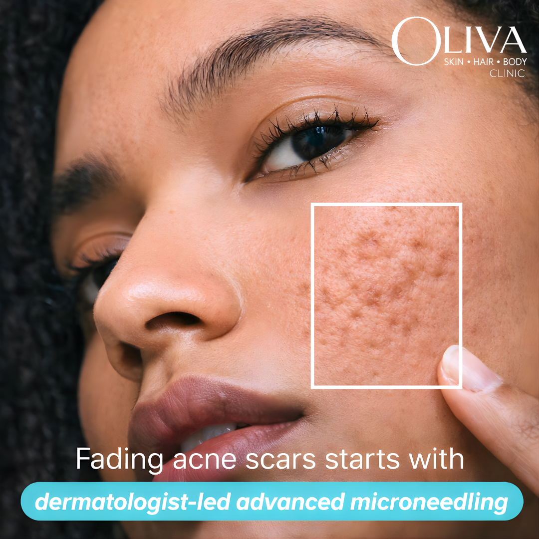 Oliva Clinic Ludhiana Facebook ad: Smoother Skin Starts Here