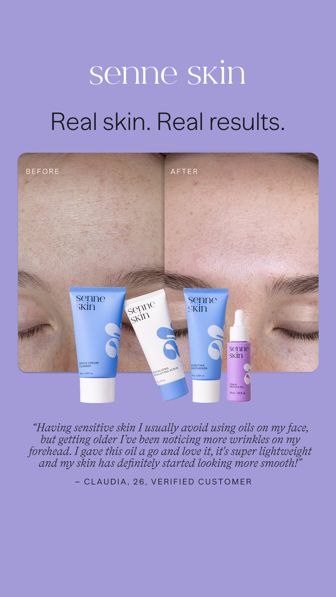 Senne Skin Facebook ad from Feb 3, 2026