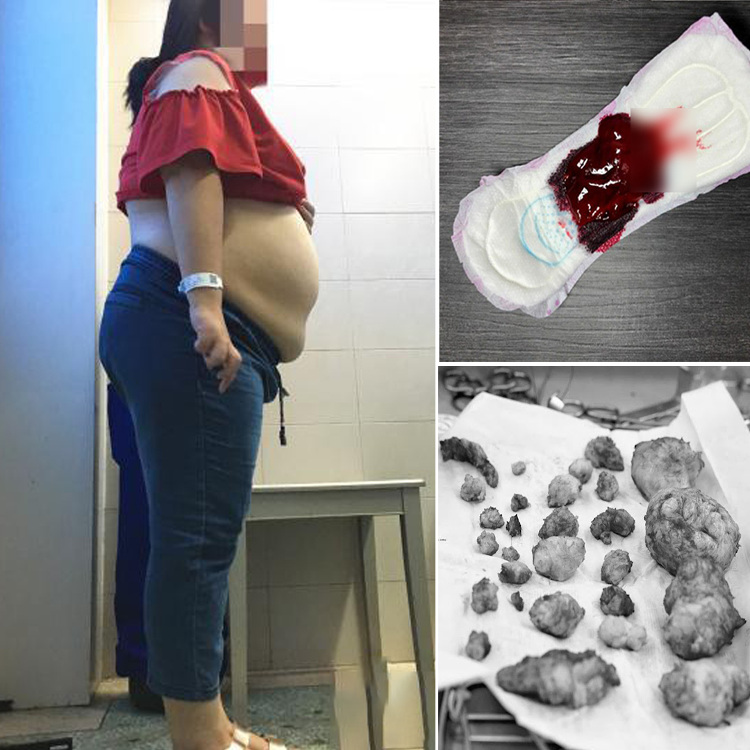 Teacher maria Facebook ad: Methods for shrinking tumors at home
