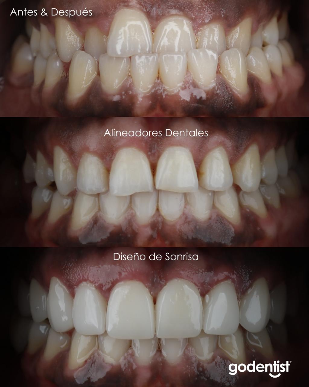 Clínicas Odontológicas Go Dentist Facebook ad