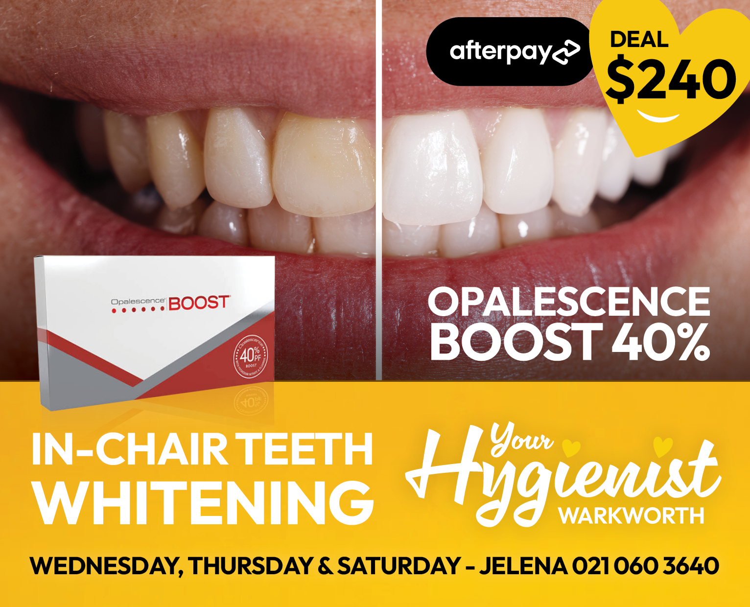 Your Hygienist Warkworth Facebook ad: Smile brighter, now with Afterpay!