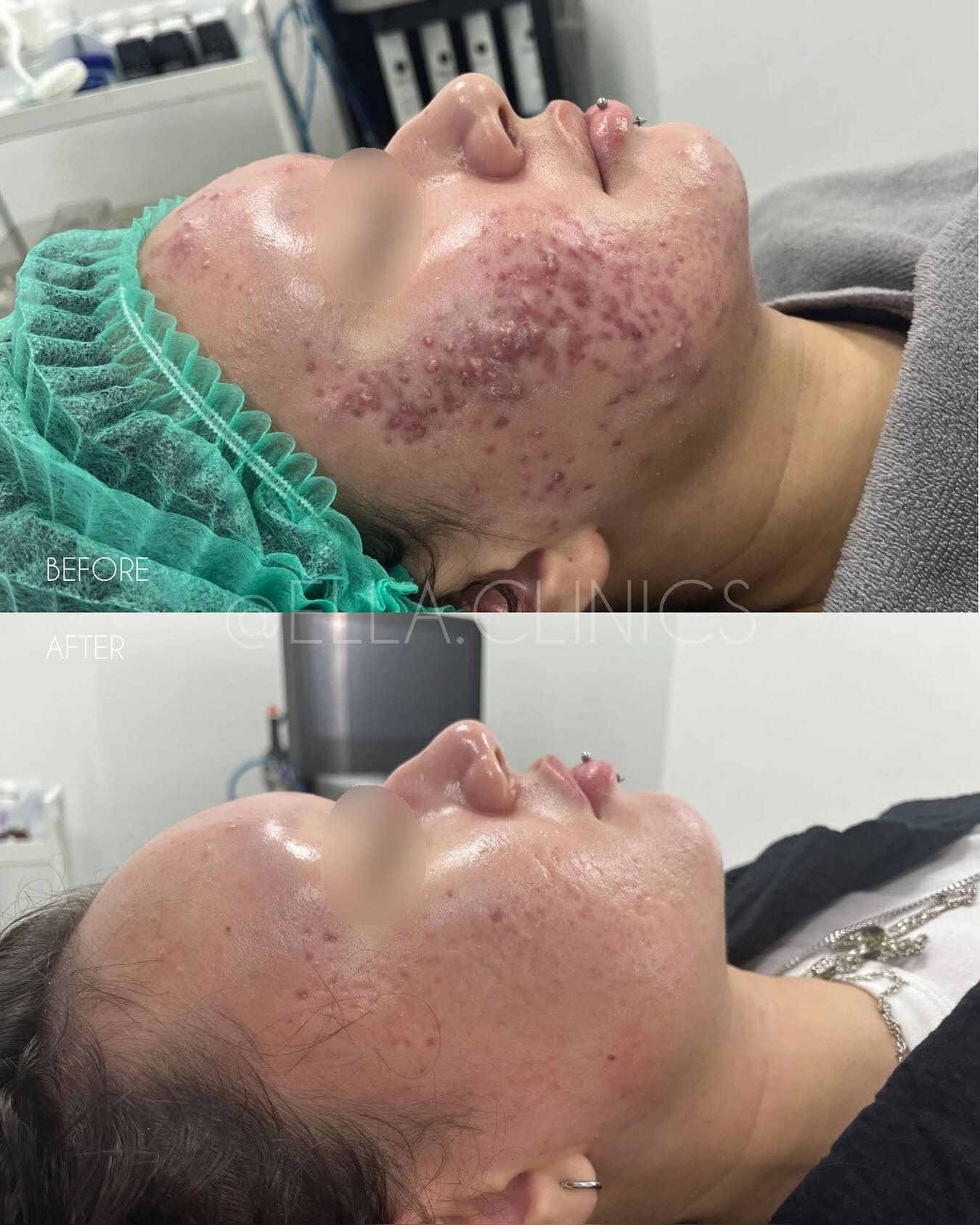 Ella Clinics Facebook ad