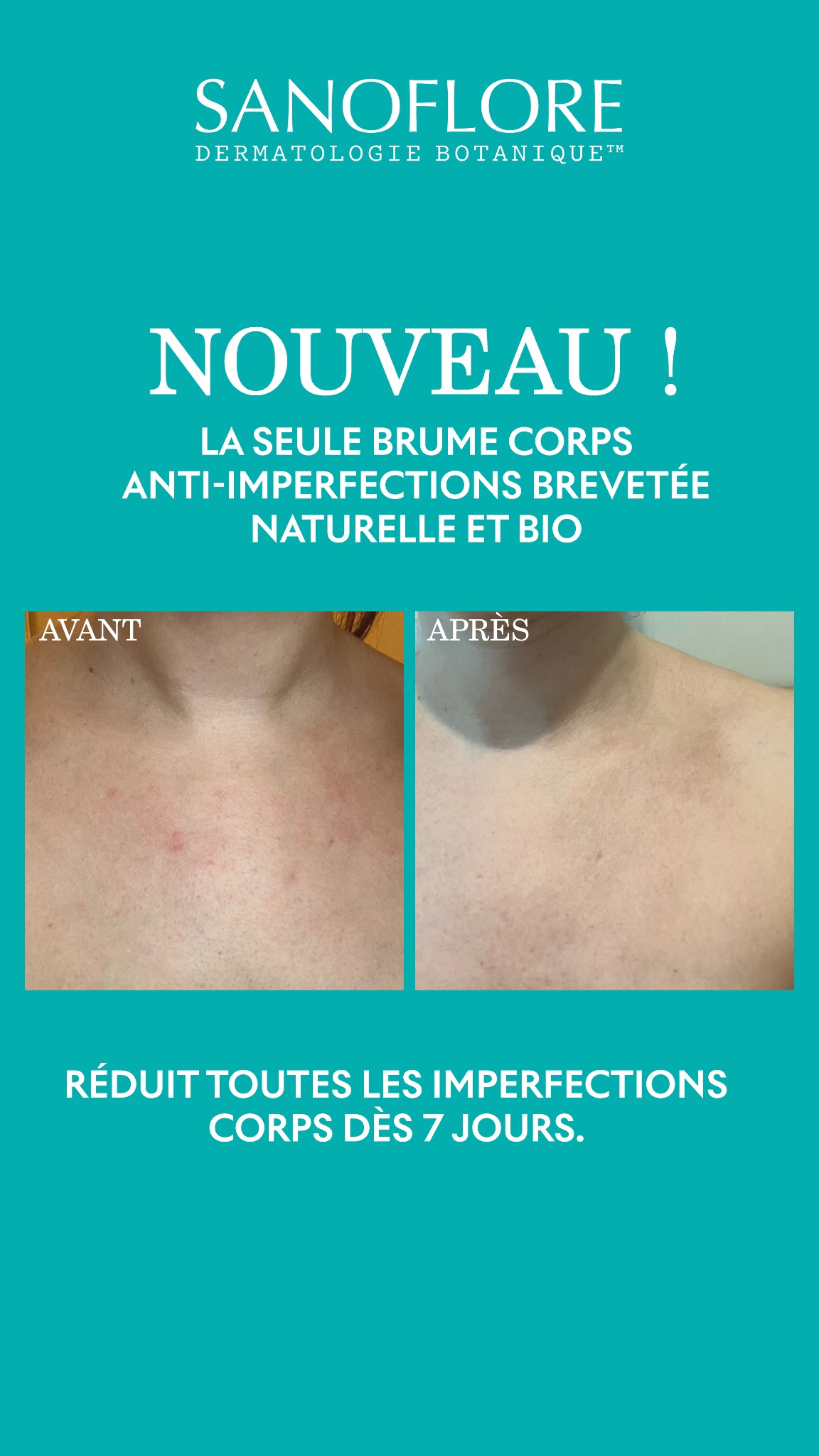 Sanoflore Facebook ad