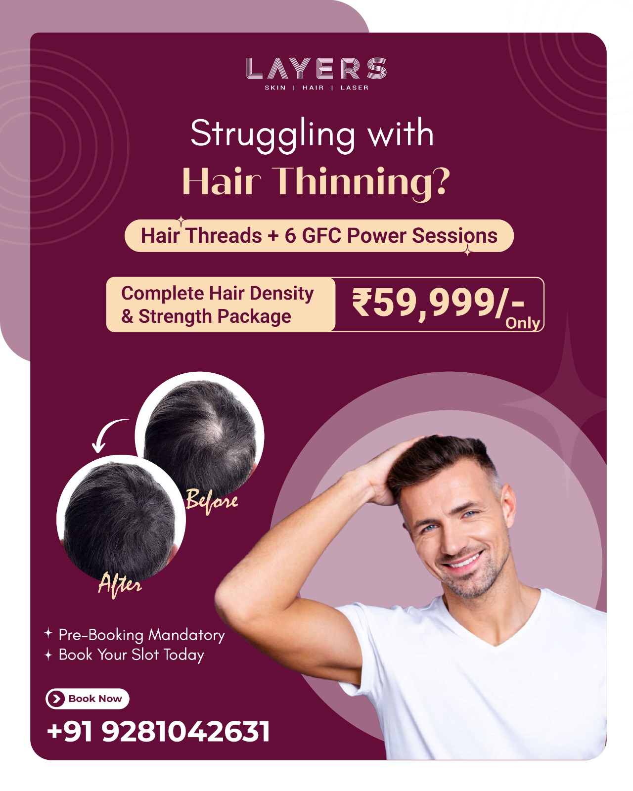 Layers Clinics Facebook ad