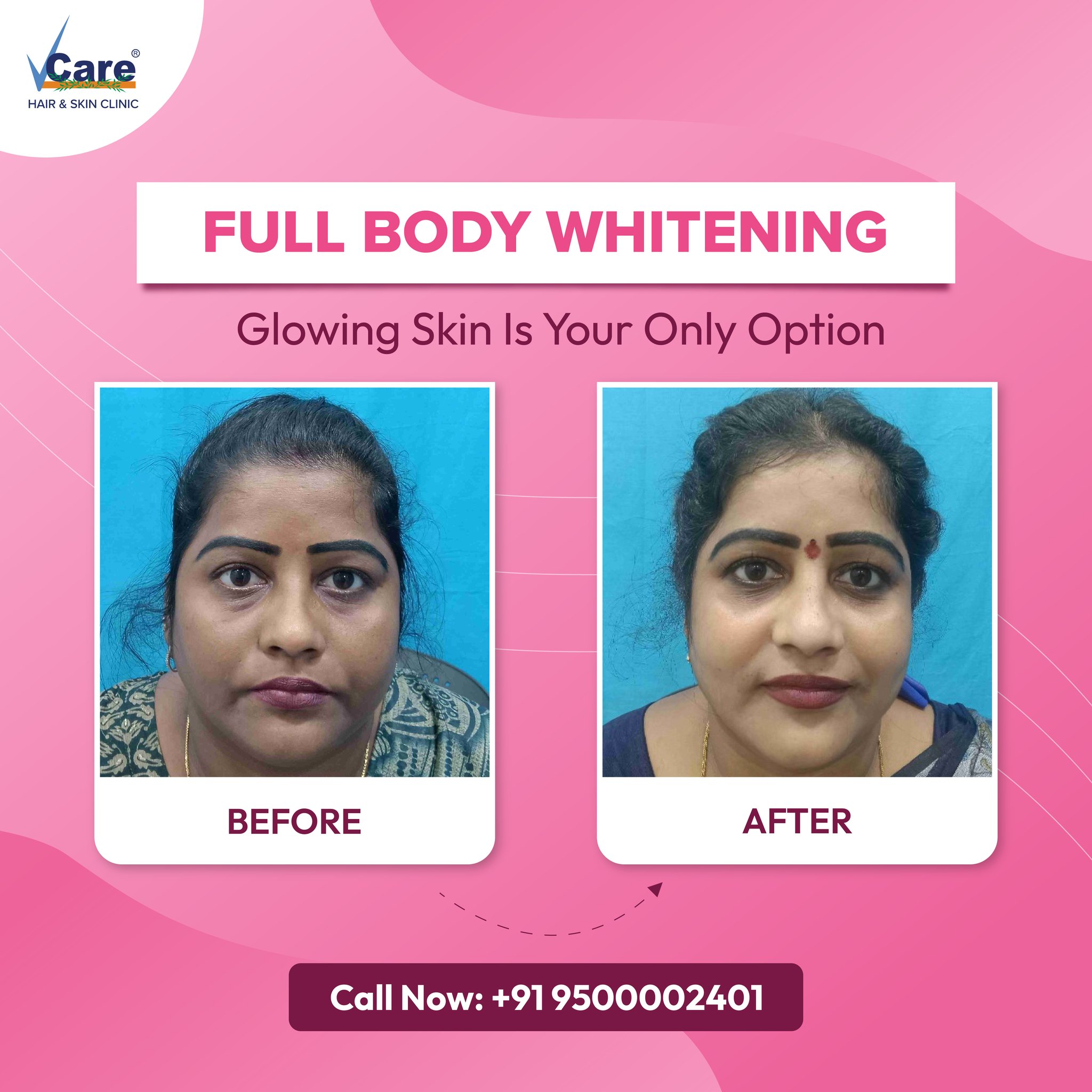 VCare Telugu Facebook ad