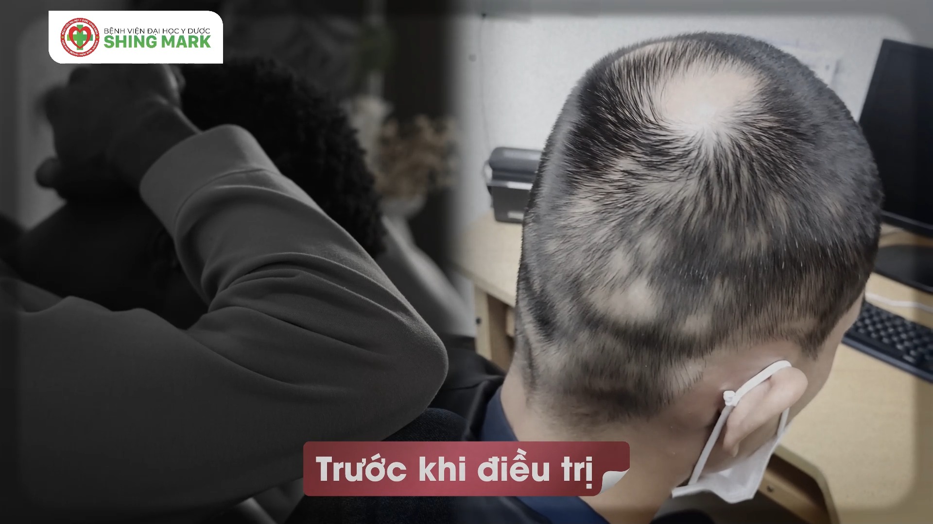 Bệnh Viện Đại Học Y Dược Shing Mark Facebook ad: Tạm biệt rụng tóc sau khi điều trị…