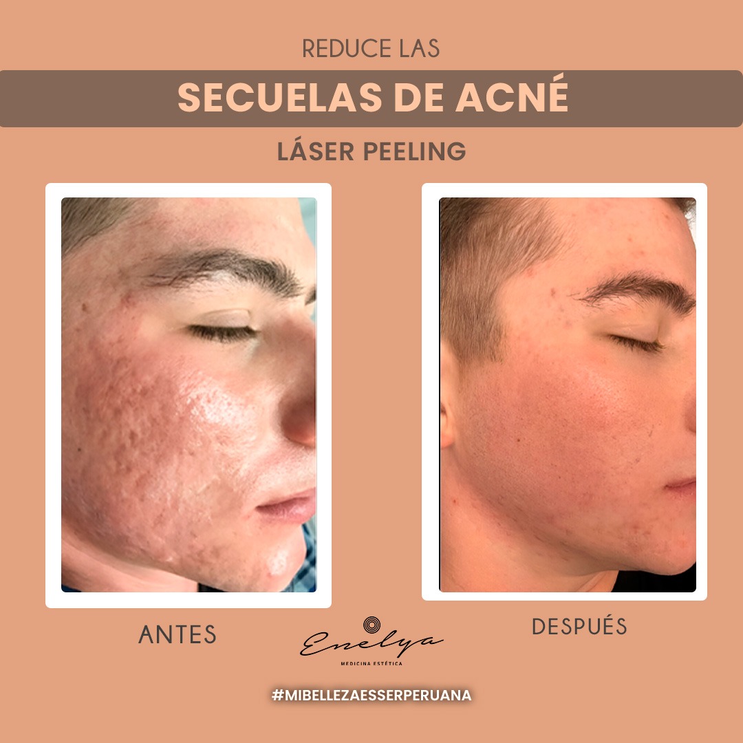 Enelya Medicina Estética Facebook ad: Transforma tu apariencia