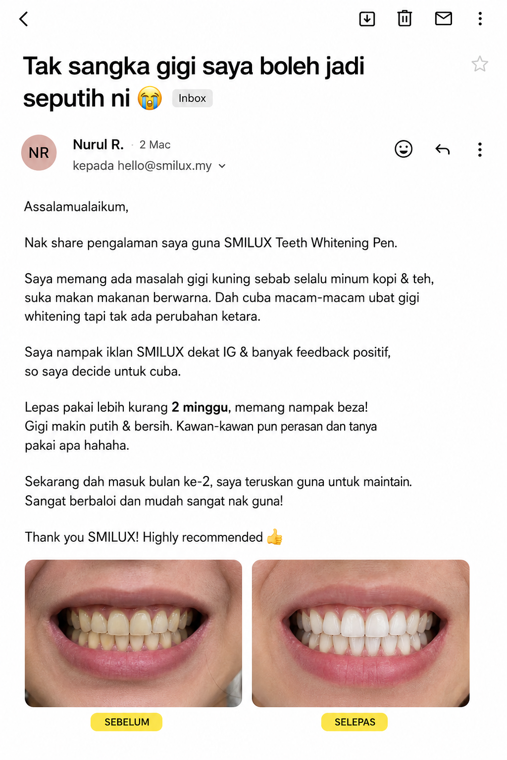 Smilux Malaysia Facebook ad: FREE SHIPPING Semenanjung FREE EXTRA STRIP untuk bulan ni