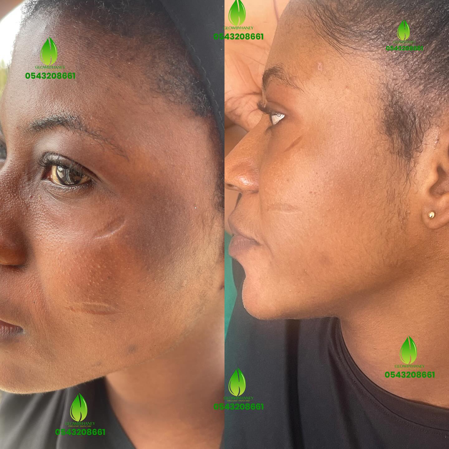 Glowbyhaney Facebook ad: HOT REVIEW