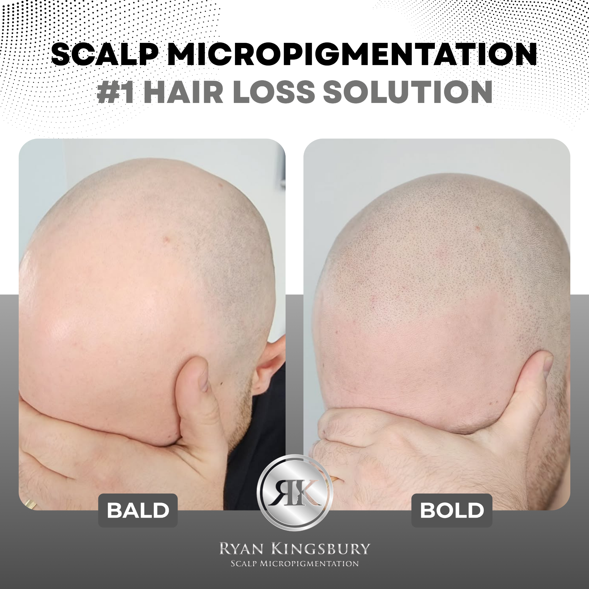 RK Scalp Micropigmentation Facebook ad