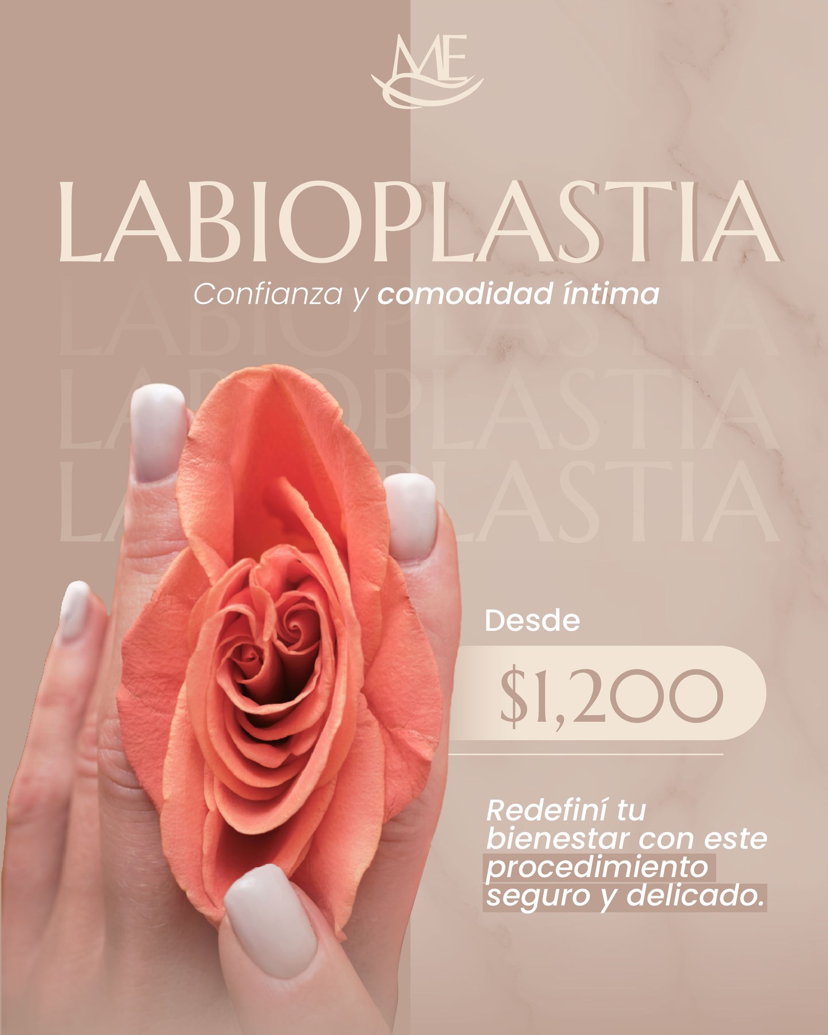 Medicina Estética Costa Rica Facebook ad: La Labioplastia es uno de los procedimientos íntimos…