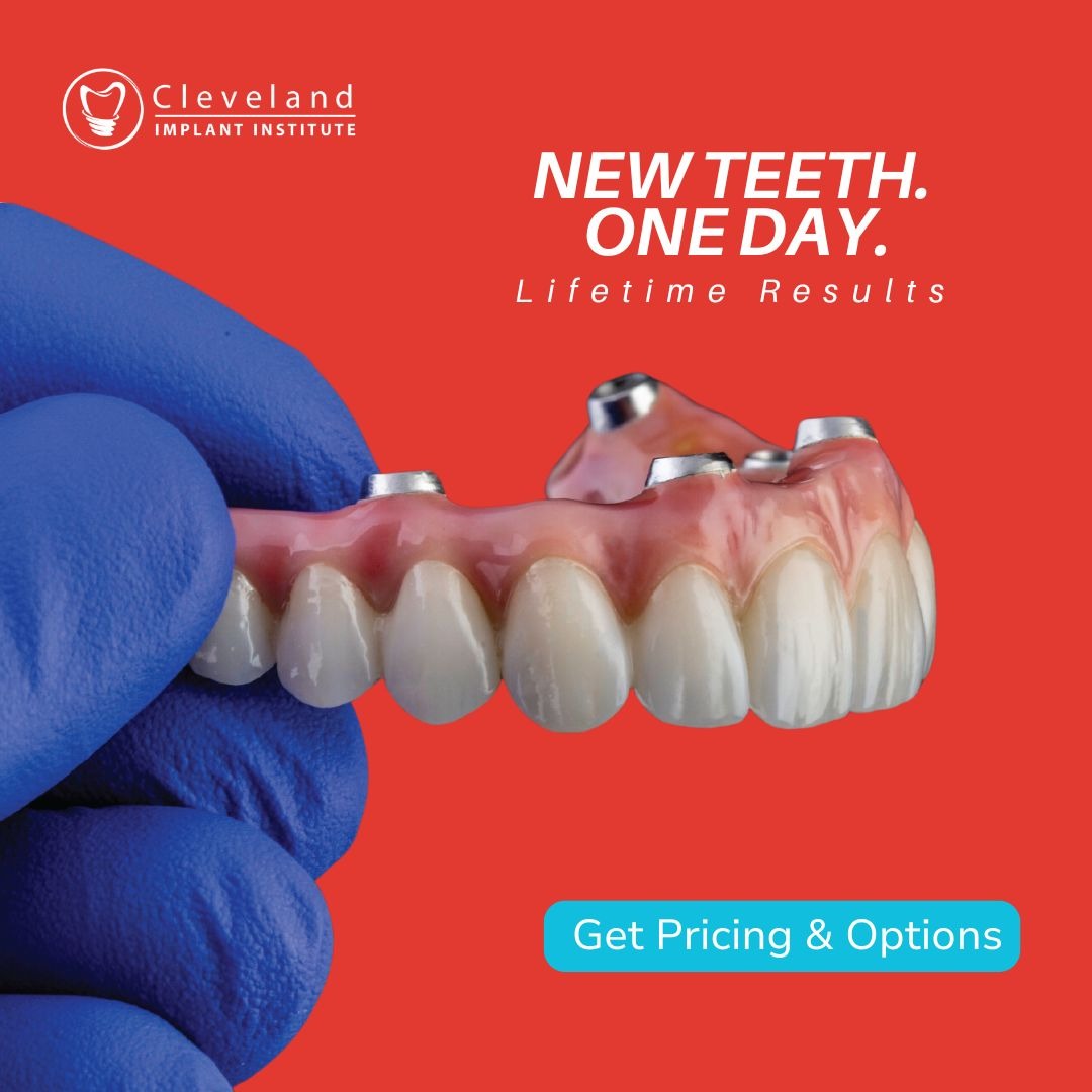 Cleveland Implant Institute Facebook ad: Discover Immediately