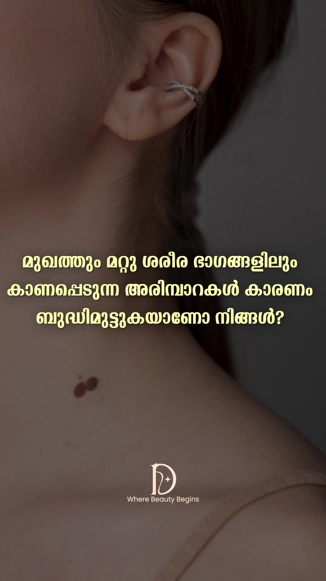 Desire Derma Skin Clinics Facebook ad: Chat with us