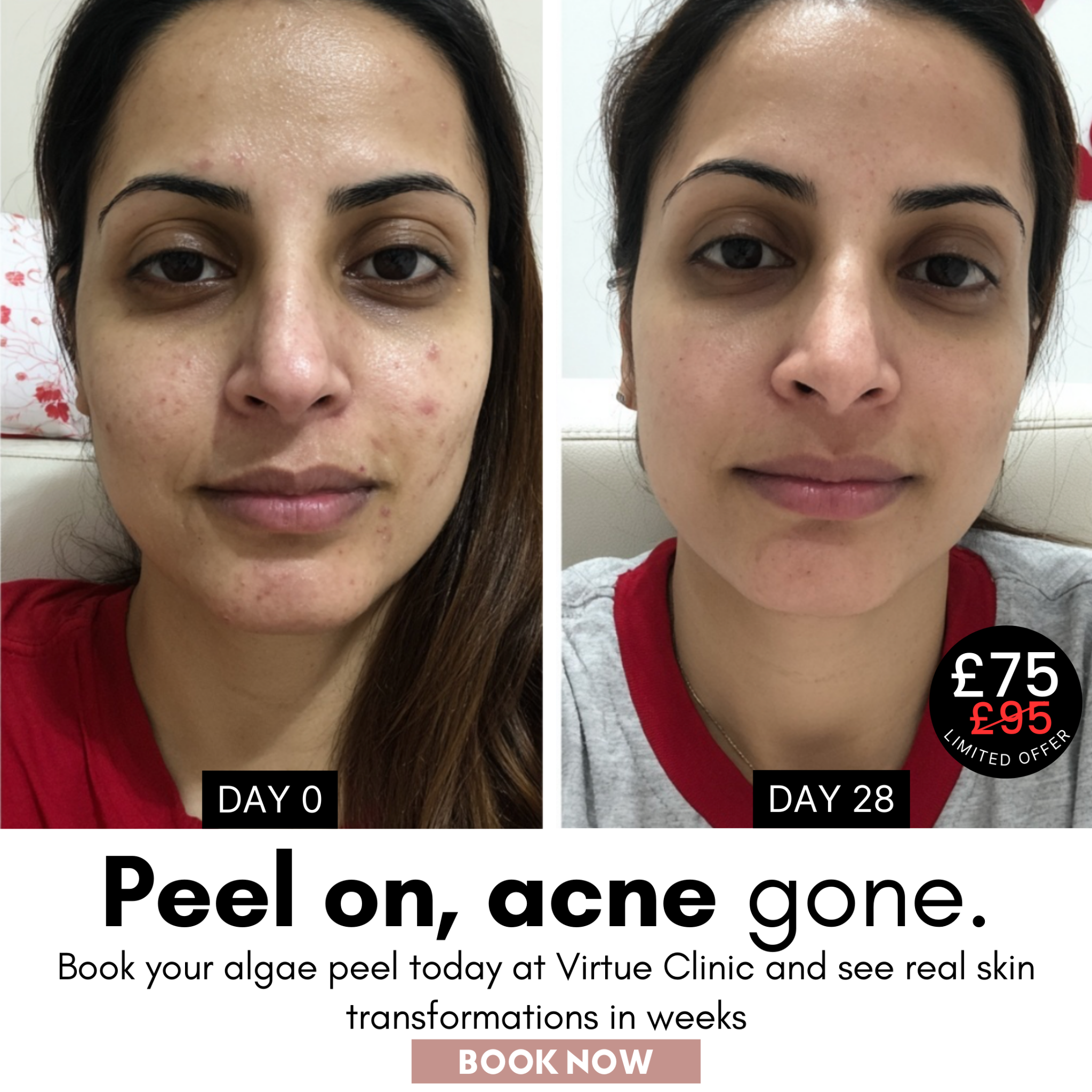 Virtue Aesthetic Treatments Facebook ad