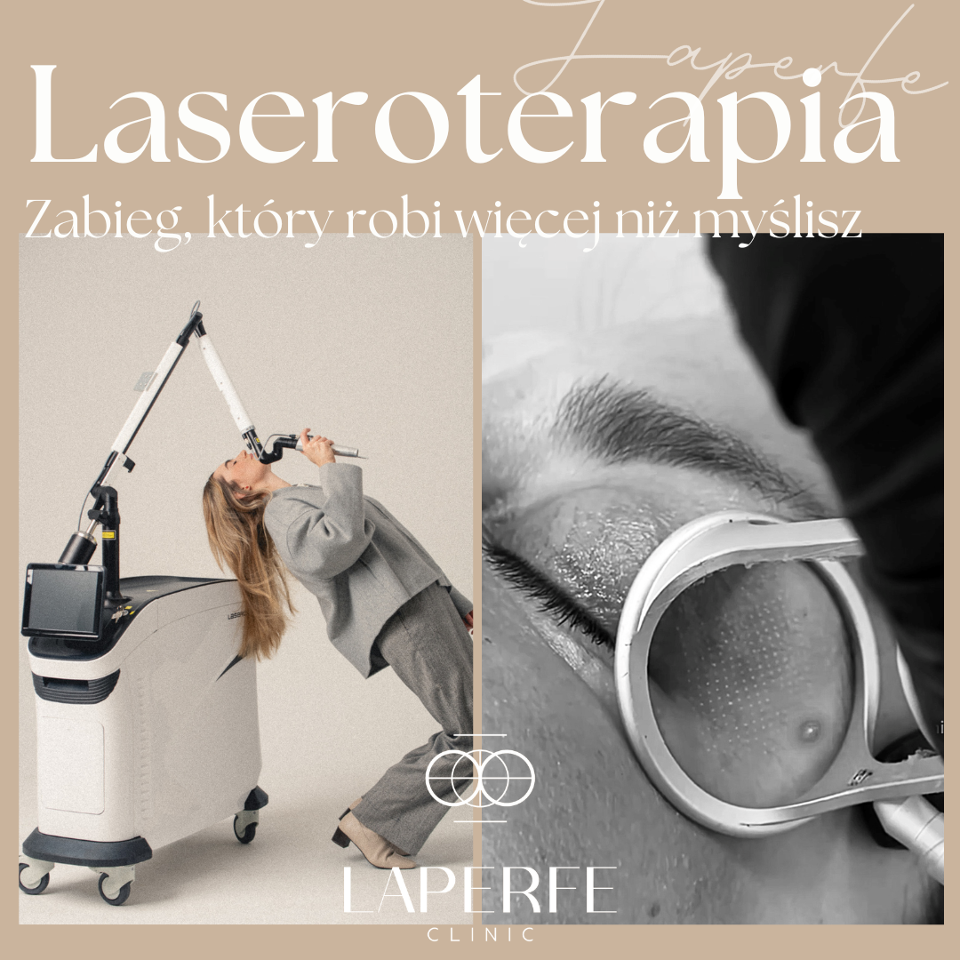 LAPERFE Facebook ad