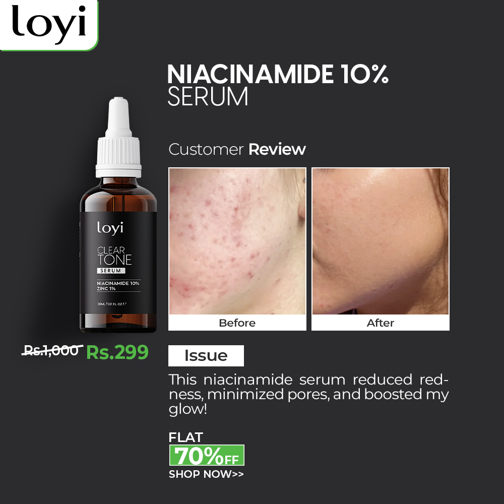 Loyi Facebook ad