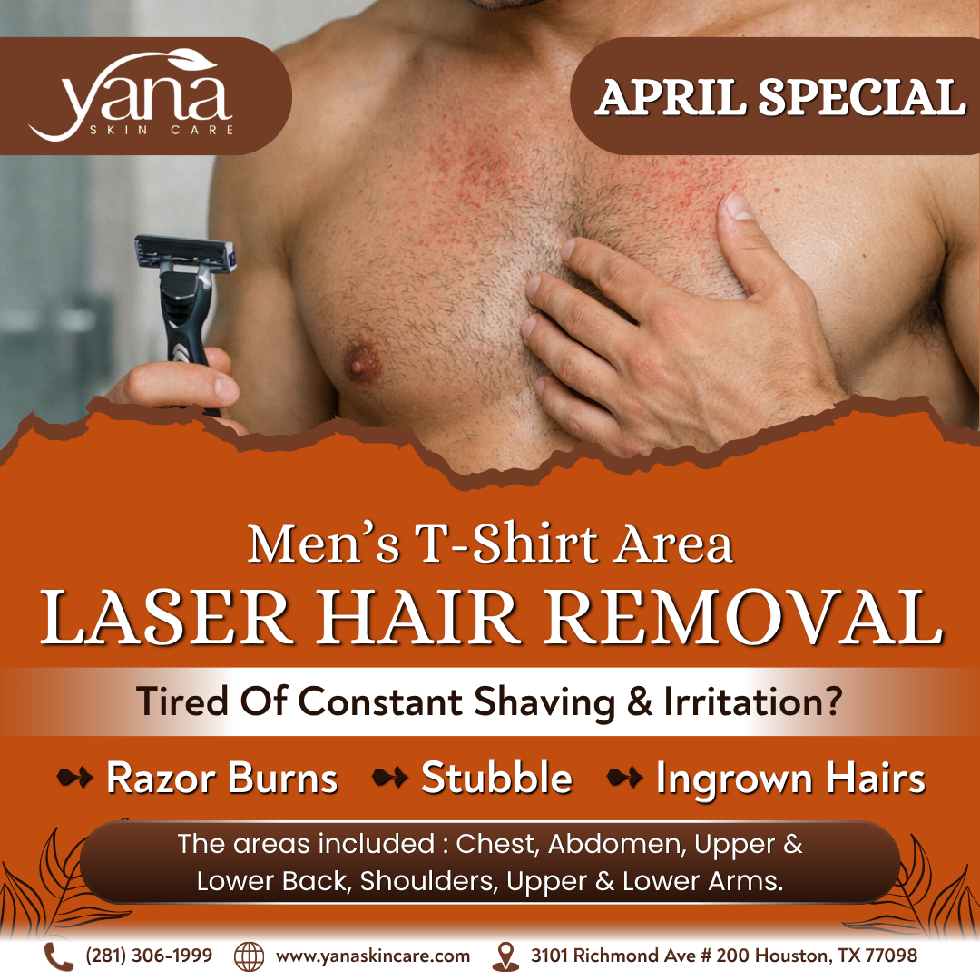 Yana Skin Care Facebook ad: **APRIL SPECIAL: Men’s T-Shirt Area Laser Hair Removal…
