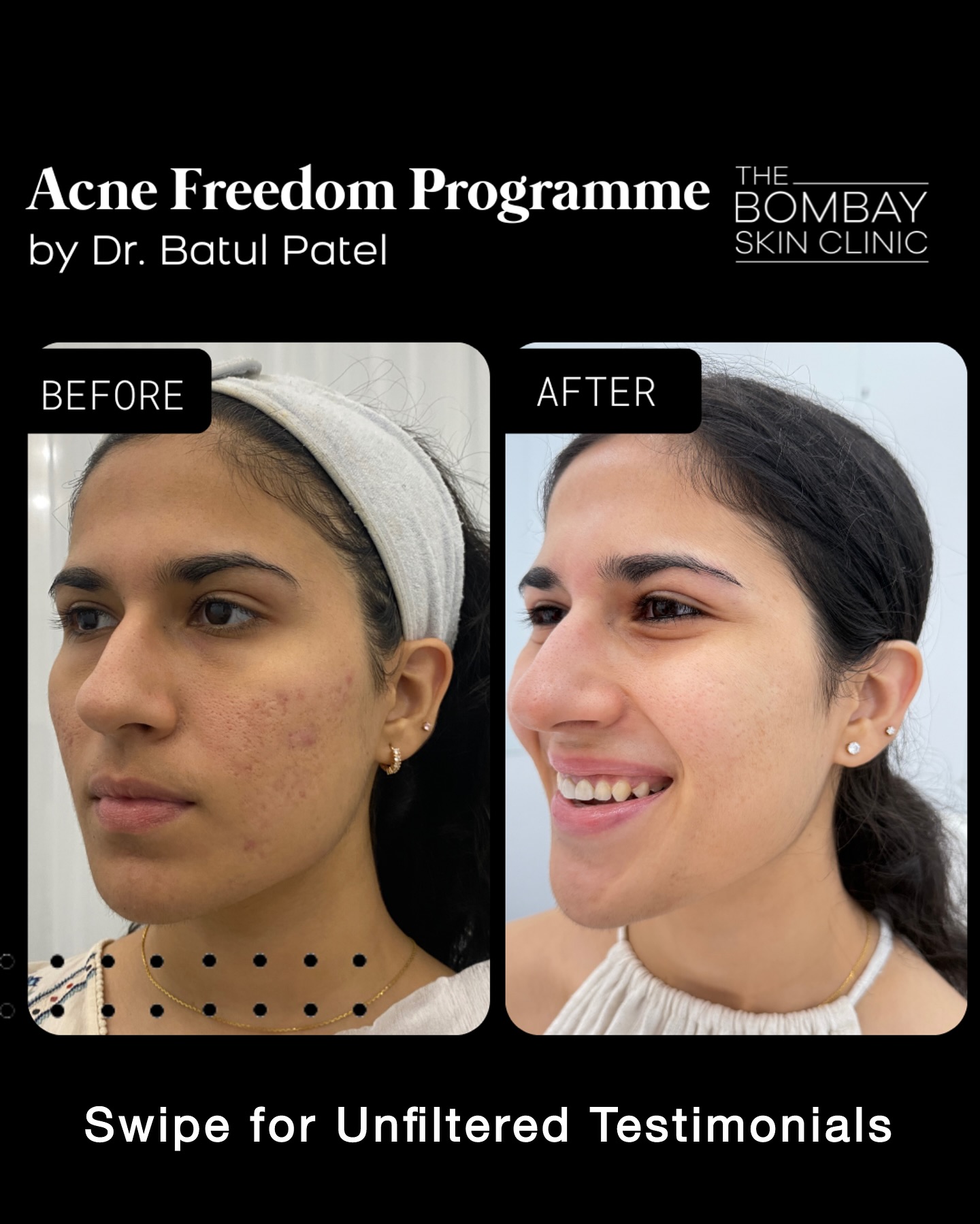 The Bombay Skin Clinic Facebook ad