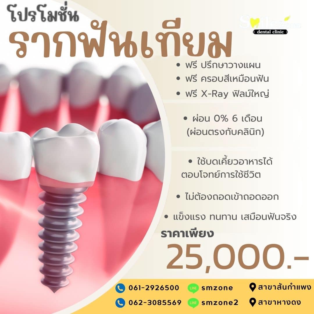 Smilezone dental clinic ทำฟัน จัดฟัน Facebook ad