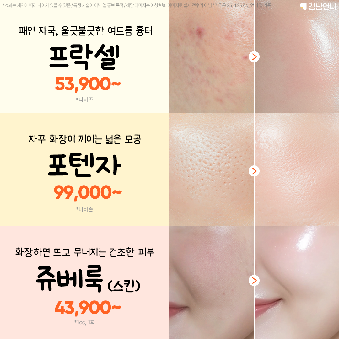 강남언니 Facebook ad