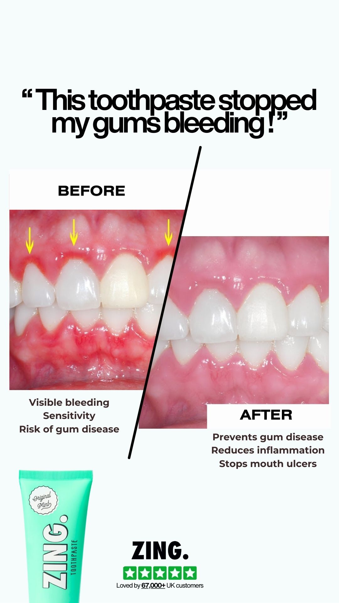 ZING. Toothpaste Facebook ad
