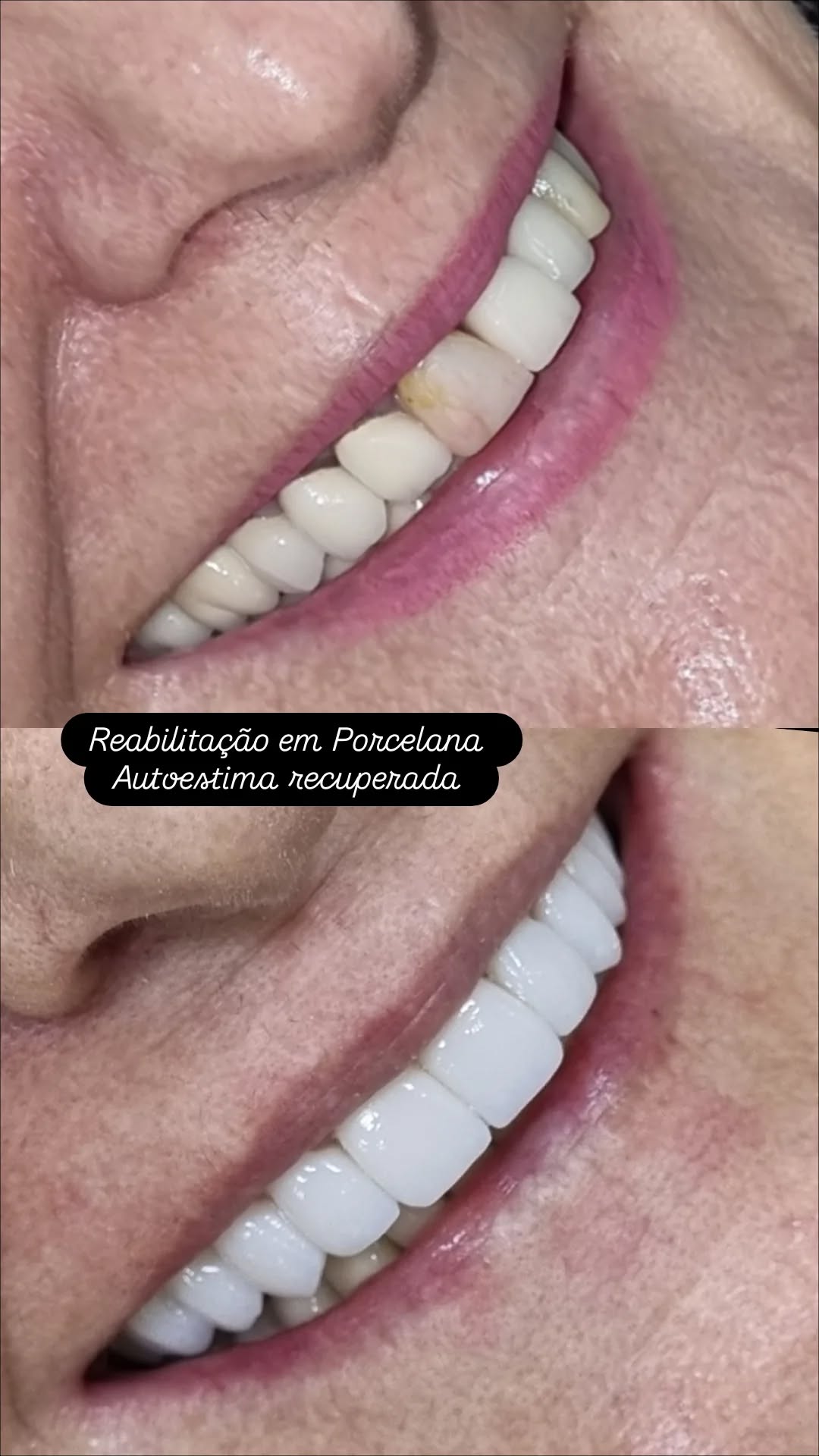 Cesar ferraz Facebook ad: Reabilitação em Porcelana
