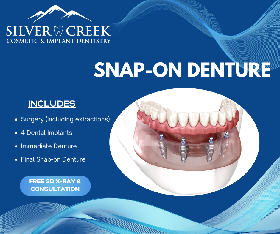 Silvercreek Family Dentistry Facebook ad: Snap-On Dentures Sale $9,000