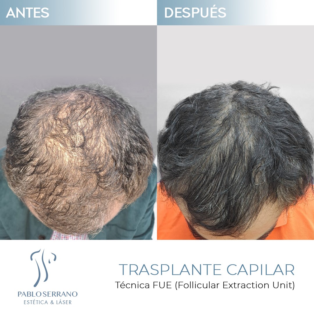 Dr. Pablo Serrano, Medicina Estética Facial. Facebook ad