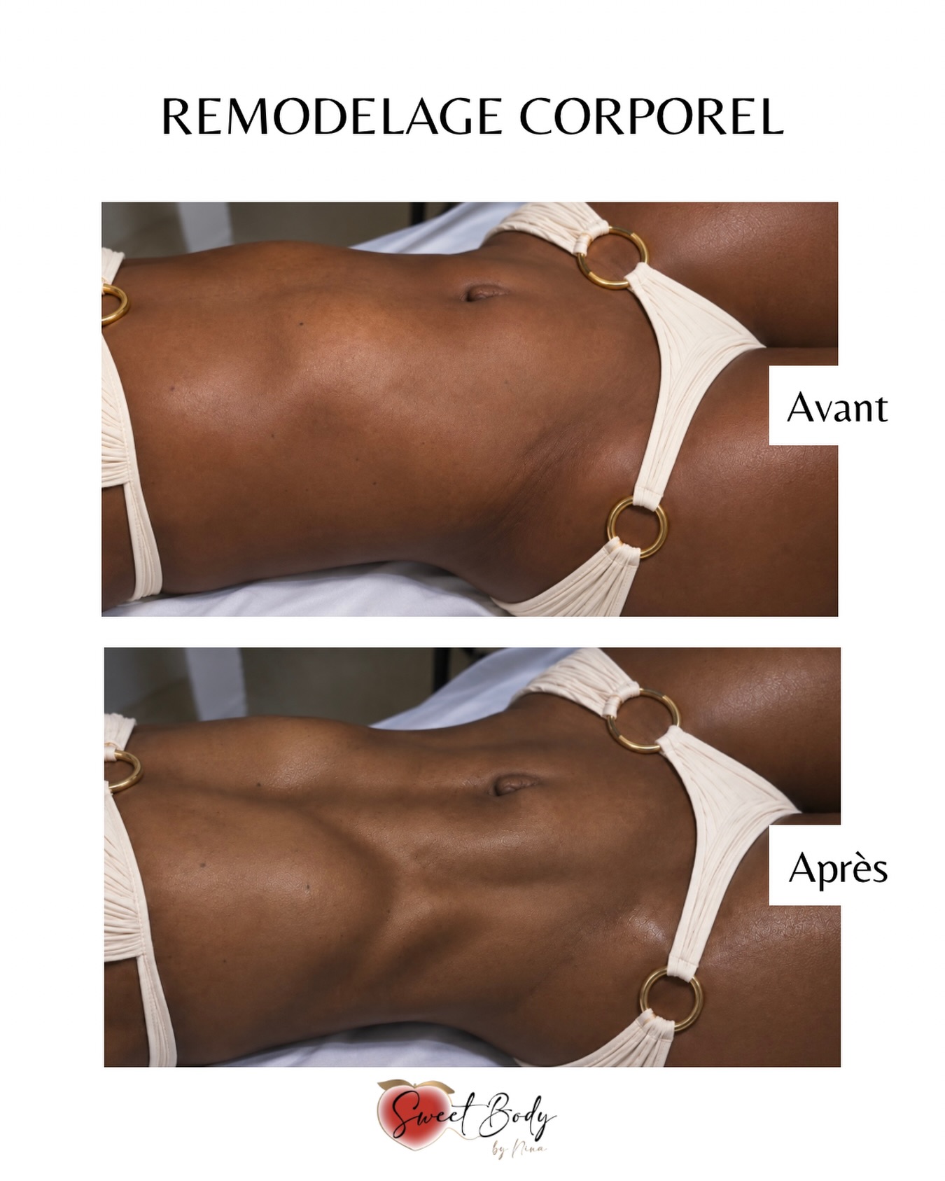 SweetBody Facebook ad: Chaque corps réagit différemment au drainage lymphatique!