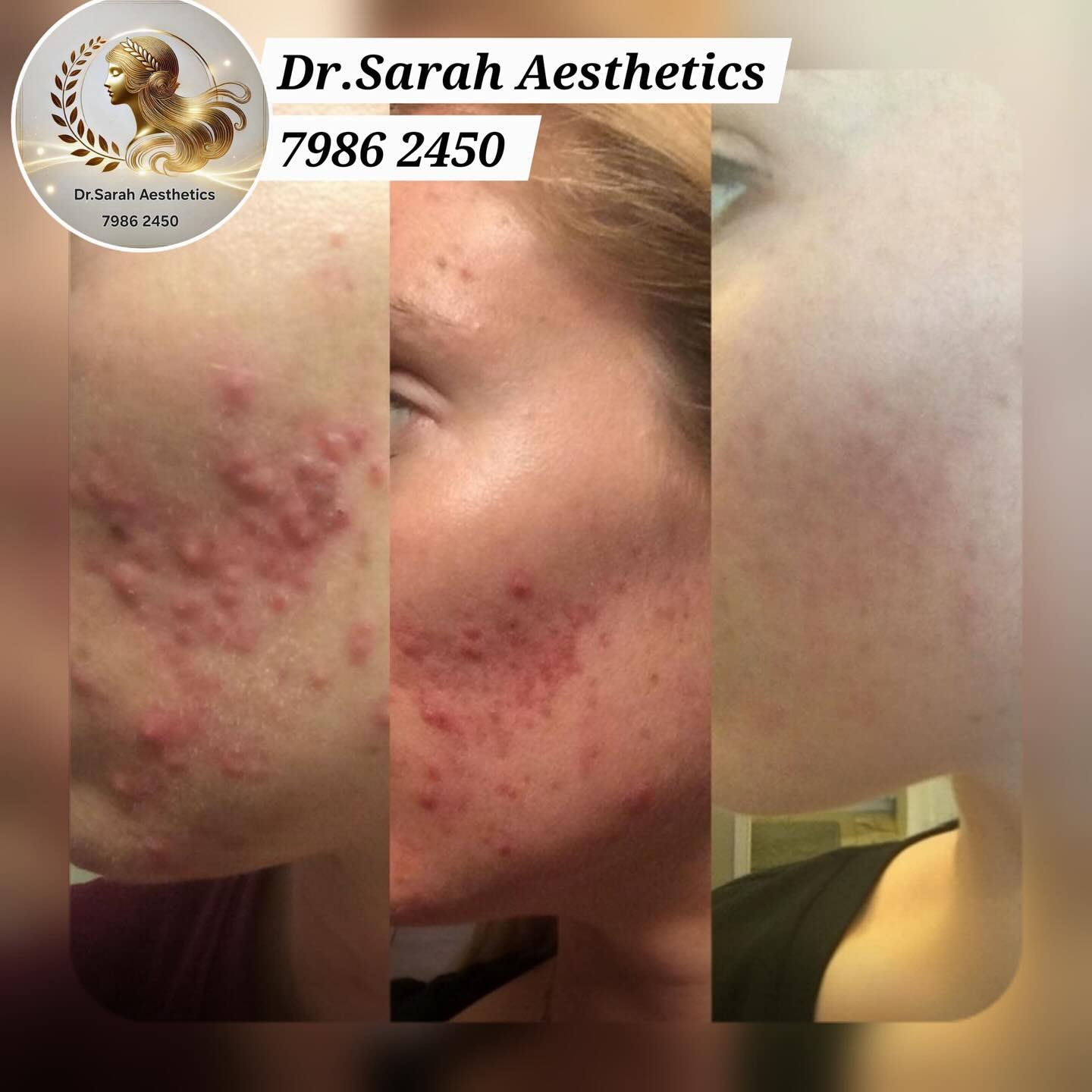 Dr.Sarah Aesthetics Facebook ad
