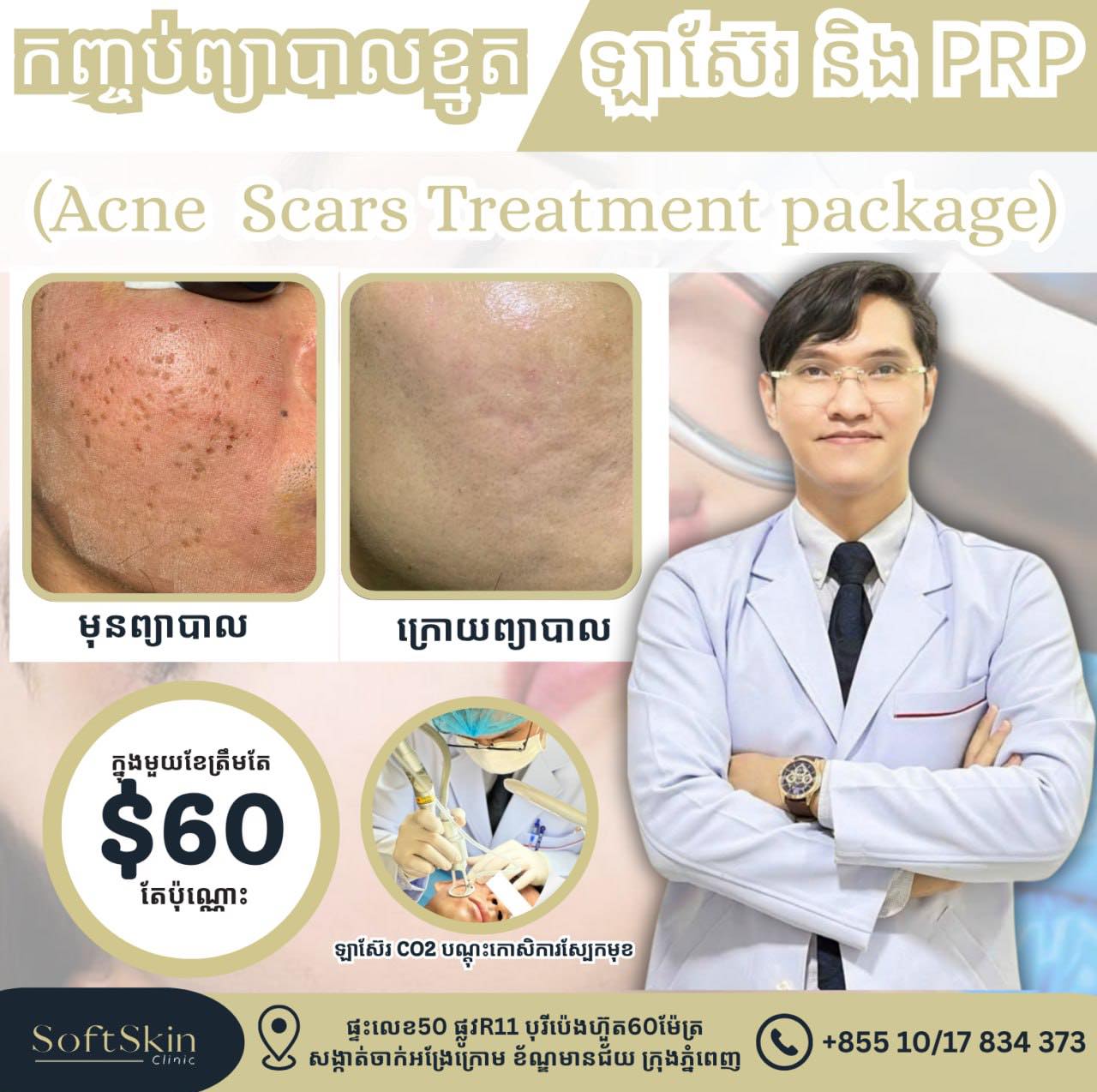 SoftSkin Clinic Facebook ad: សេវាកម្ម Laser Co2+PRP ជាវិធីសាស្ត្រព្យាបាលលើបញ្ហាស្នាមខ្មូ…