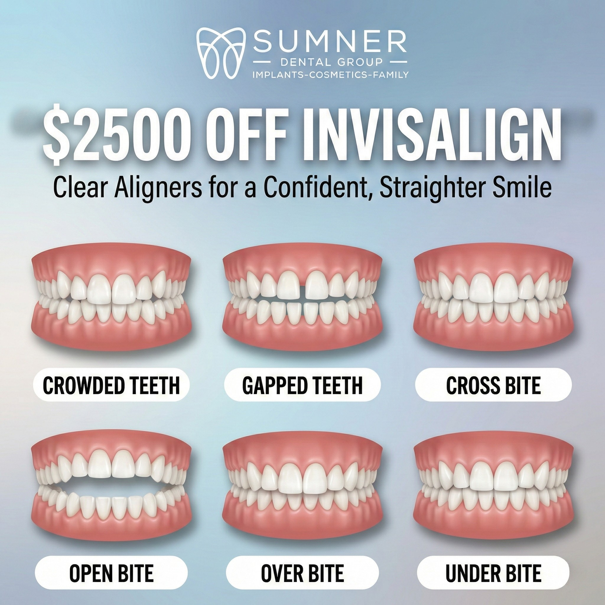 Sumner Dental Group - Dentist Gallatin Facebook ad: $2500 OFF On Invisalign Treatment!