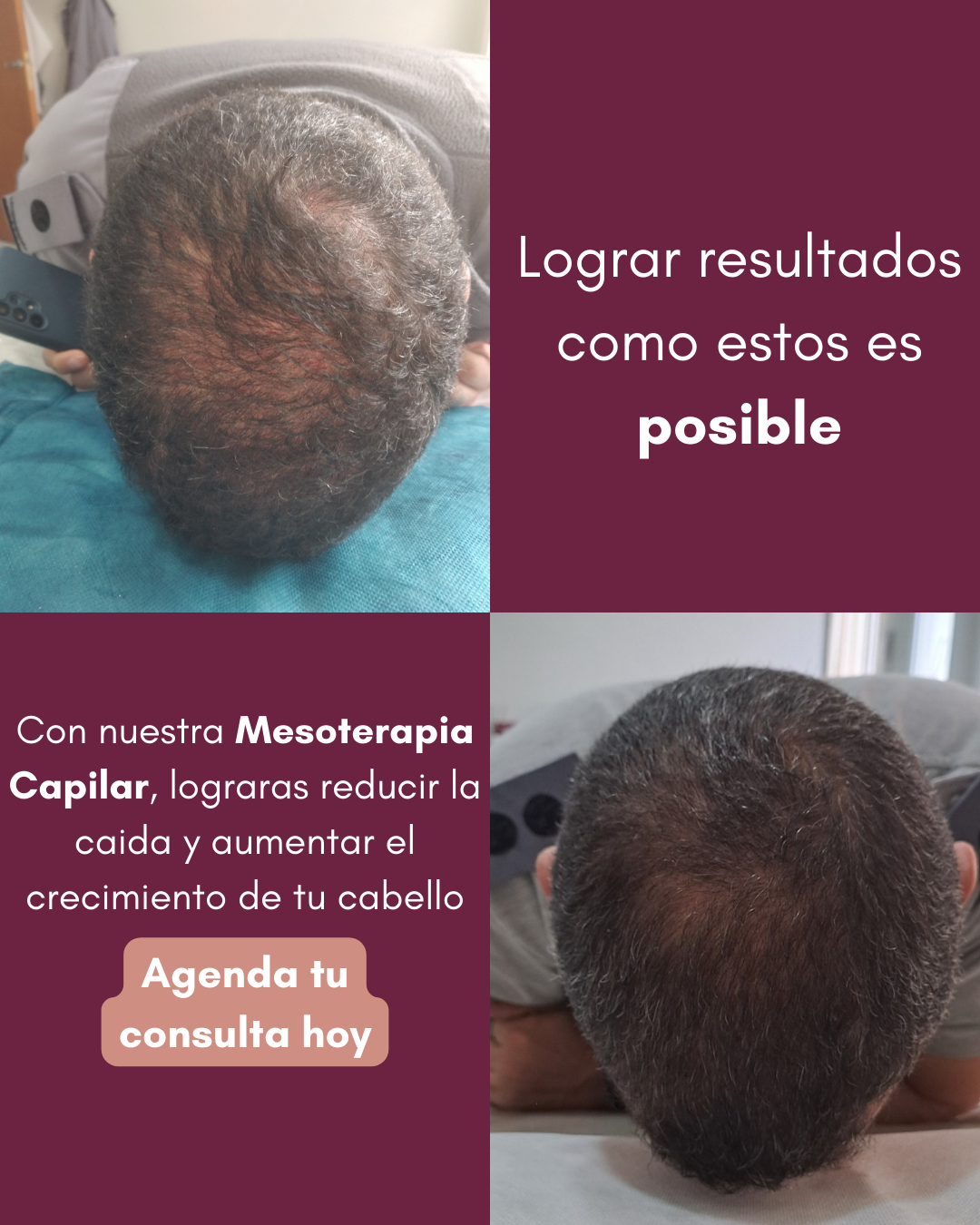 MedEstética Facebook ad