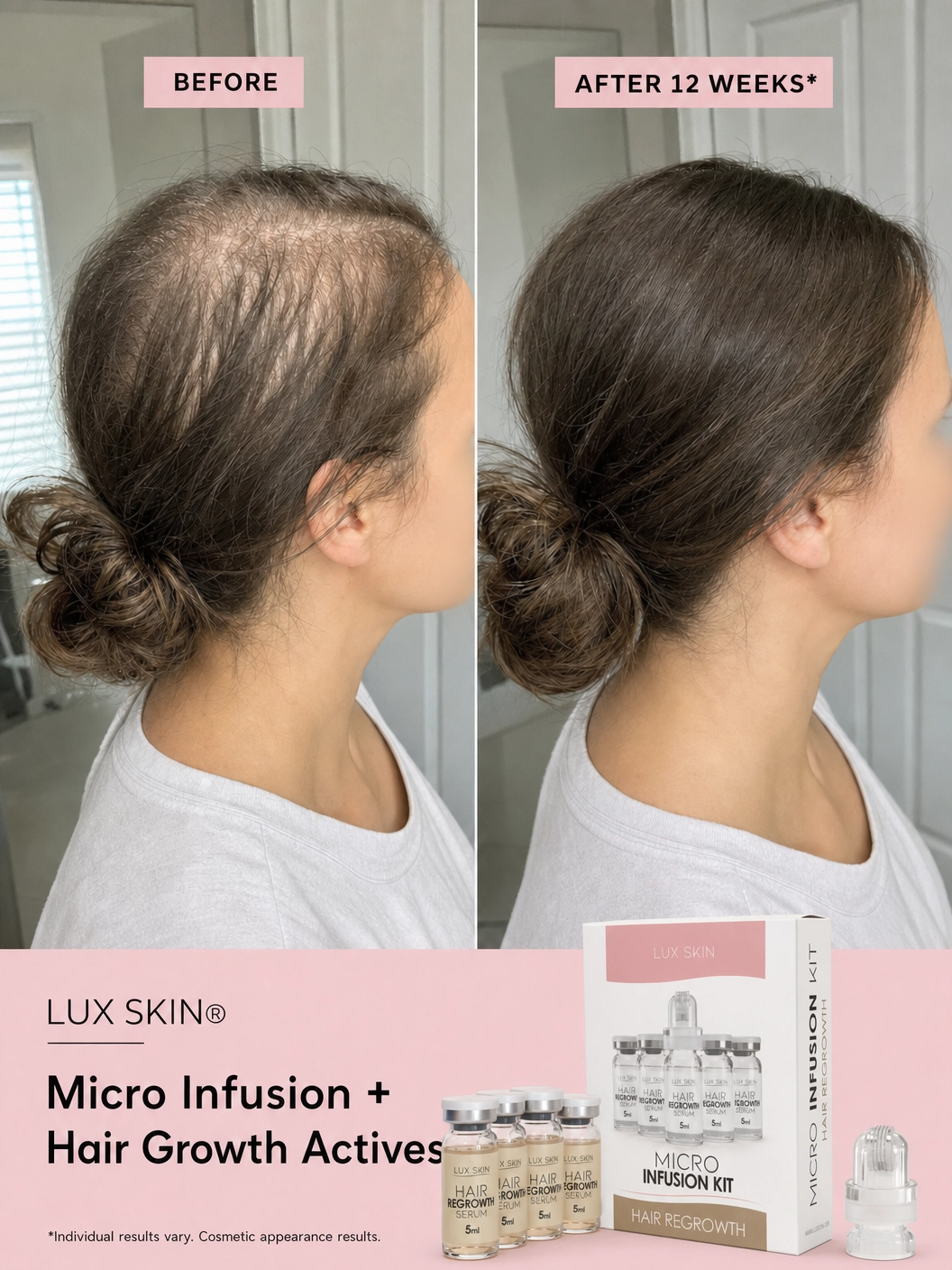 LUX SKIN Facebook ad