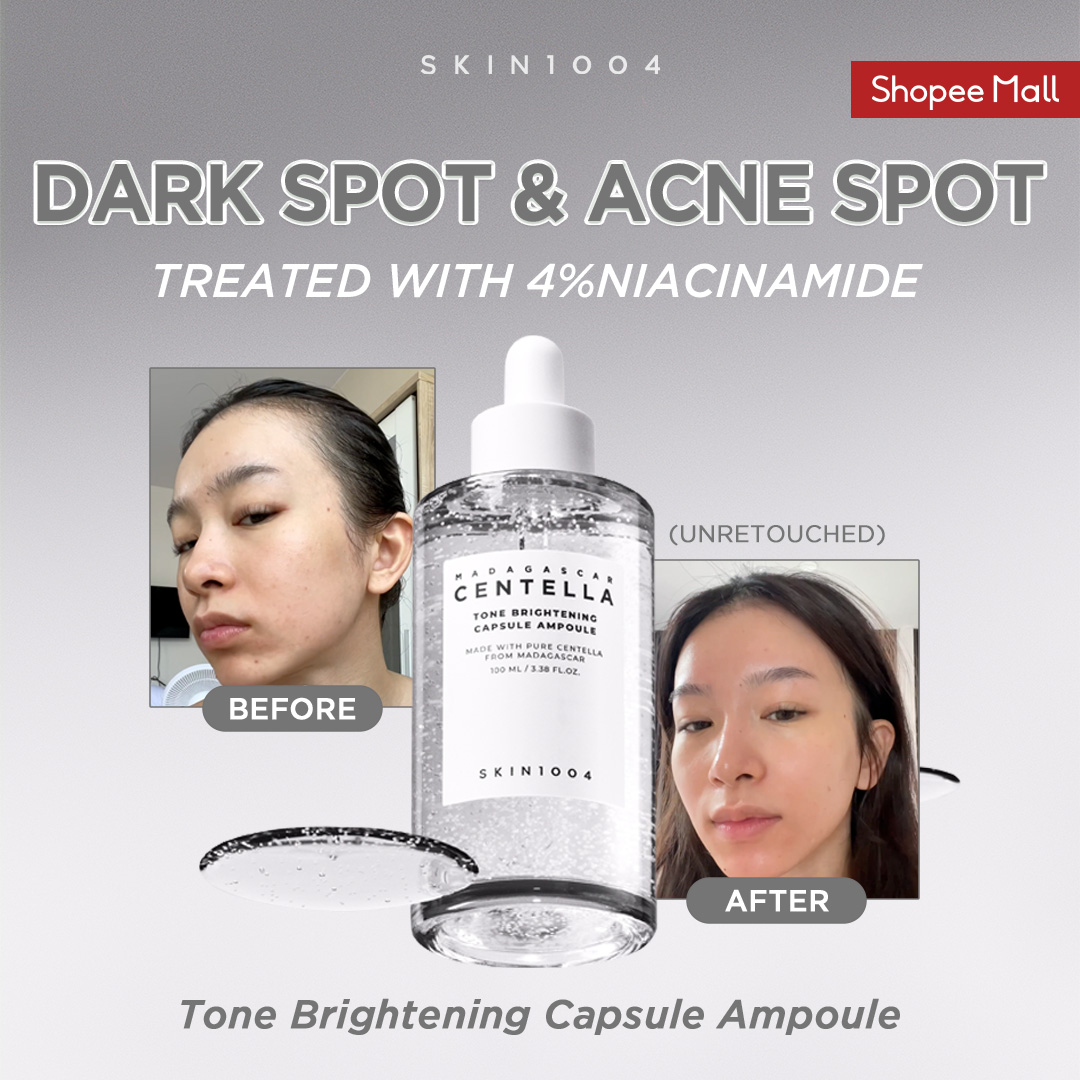 SKIN1004 Philippines Facebook ad