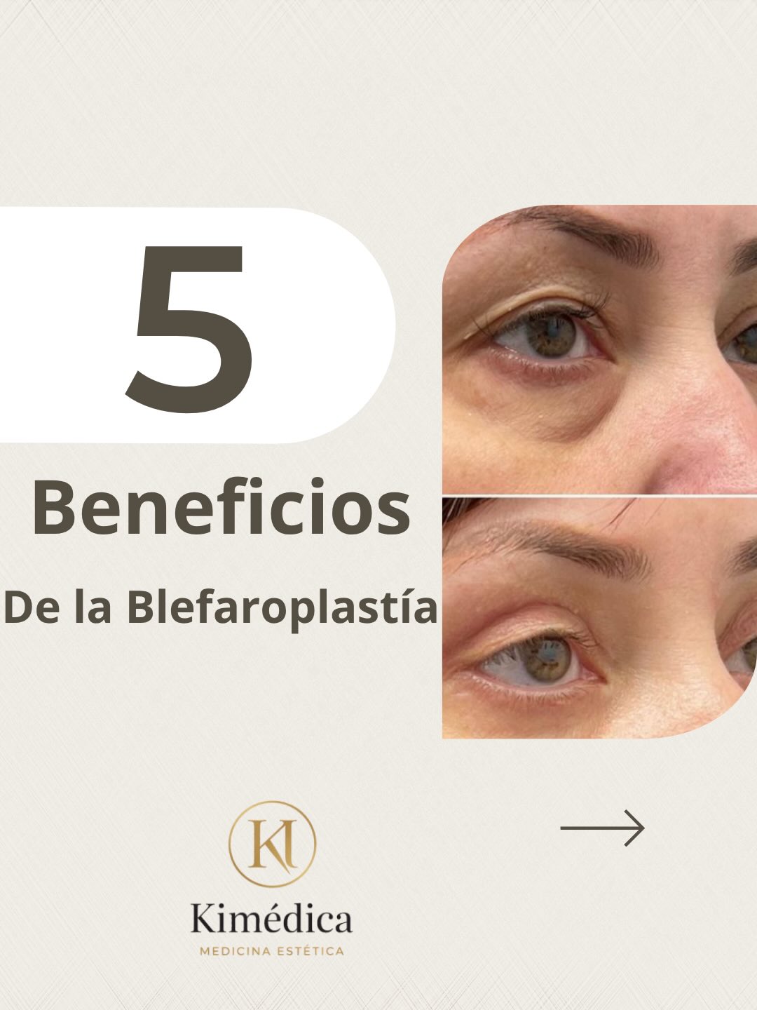 Kimedica Dra Merayo Facebook ad: Procedimiento seguro, preciso y realizado bajo valoración…